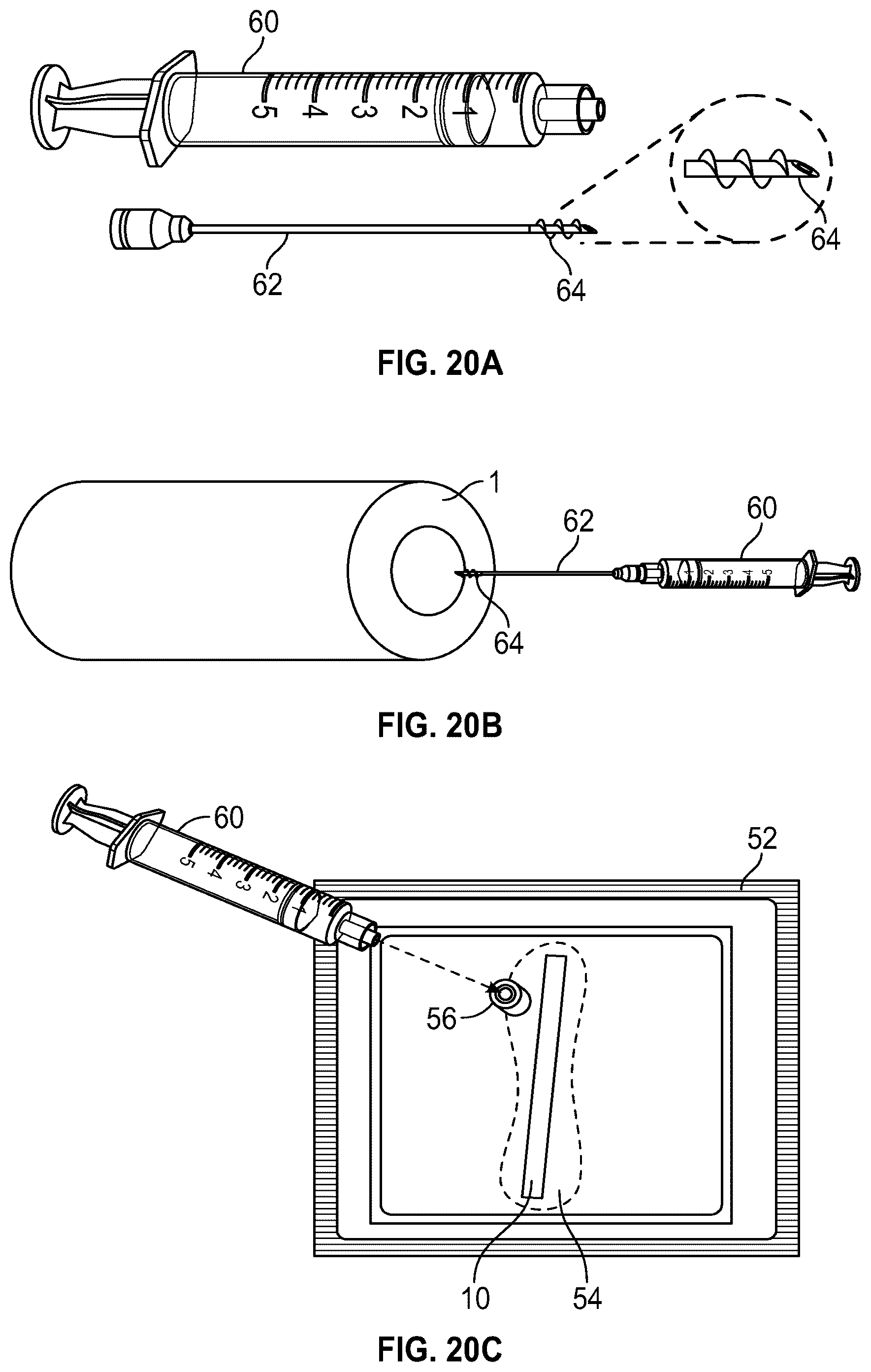 Patent US12588999 Figure 14 – System and method to fuse bone