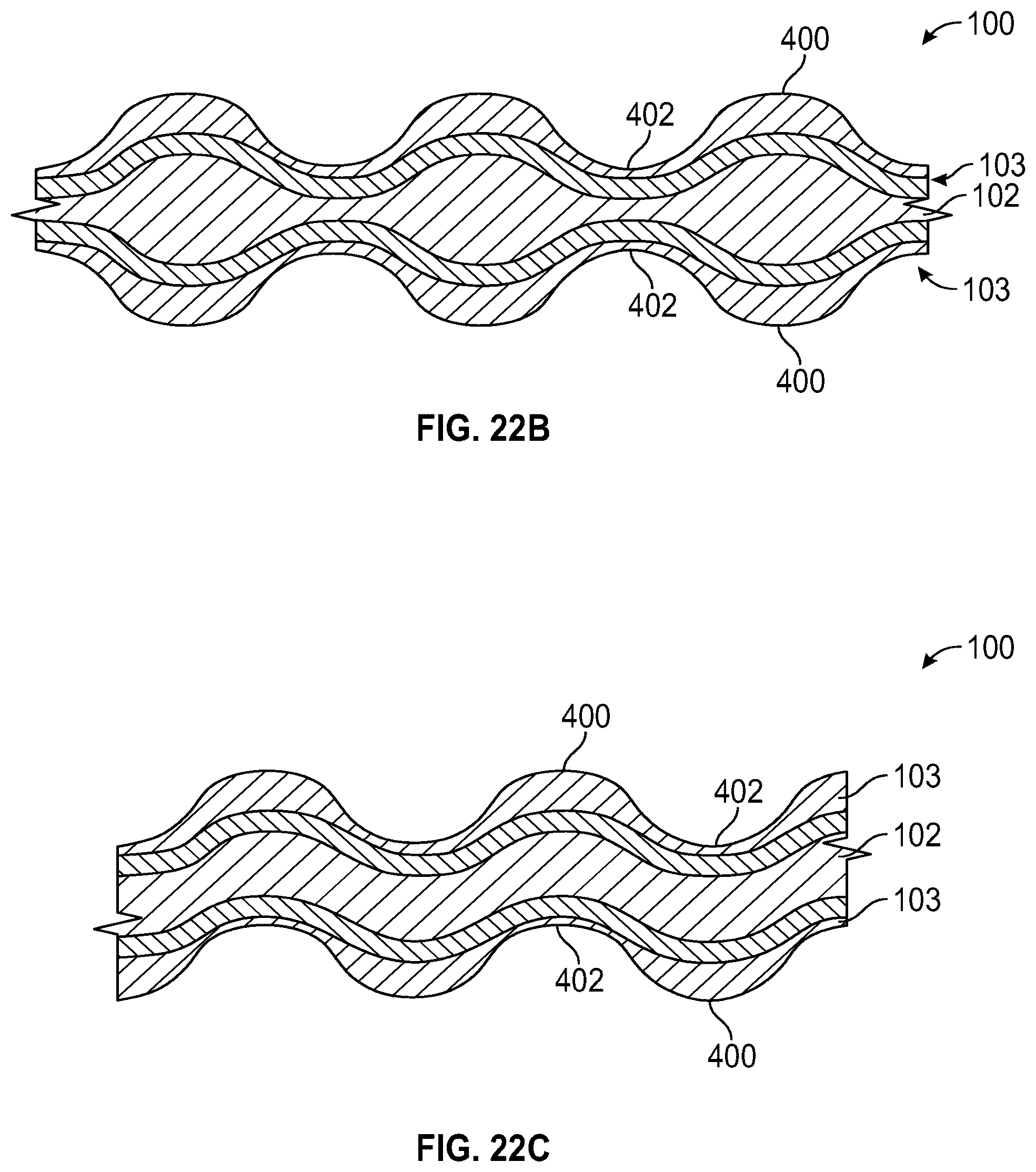 Patent US12588999 Figure 16 – System and method to fuse bone
