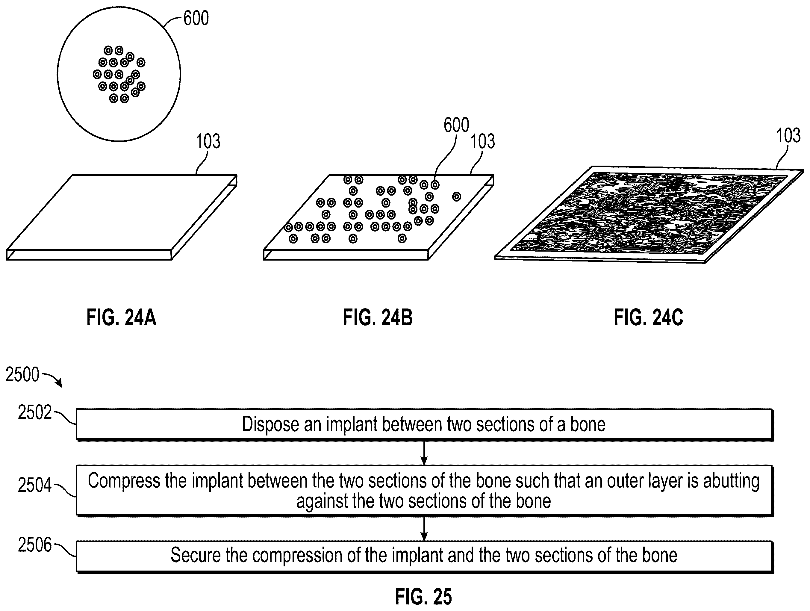 Patent US12588999 Figure 18 – System and method to fuse bone