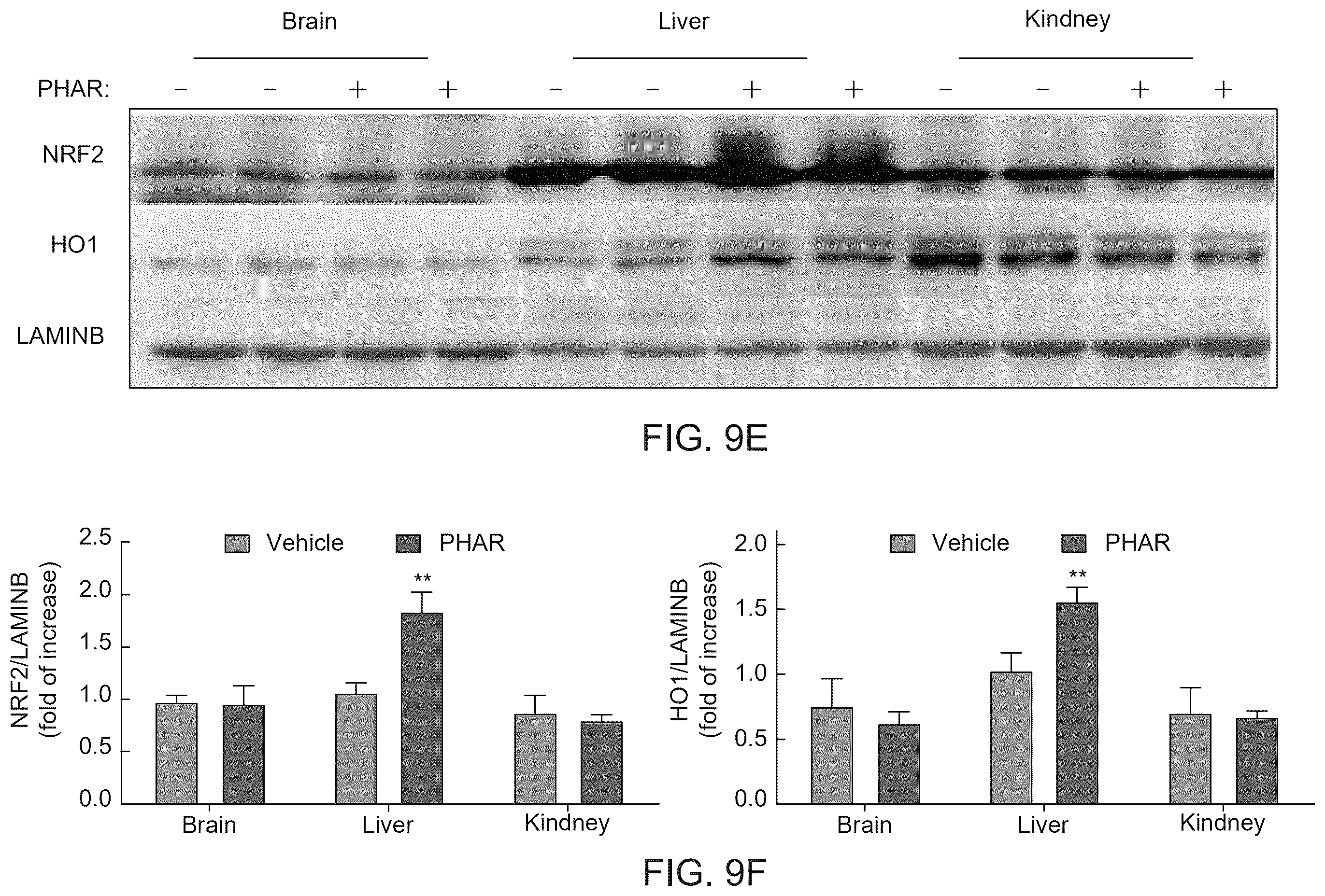 Patent US12590100 Figure 15 – Tetrahydro-spiroindoline-pyrrolopyrrole-triones inhibitors of the NRF2-β-TrCP interaction for use in the treatment of fatty liver disease
