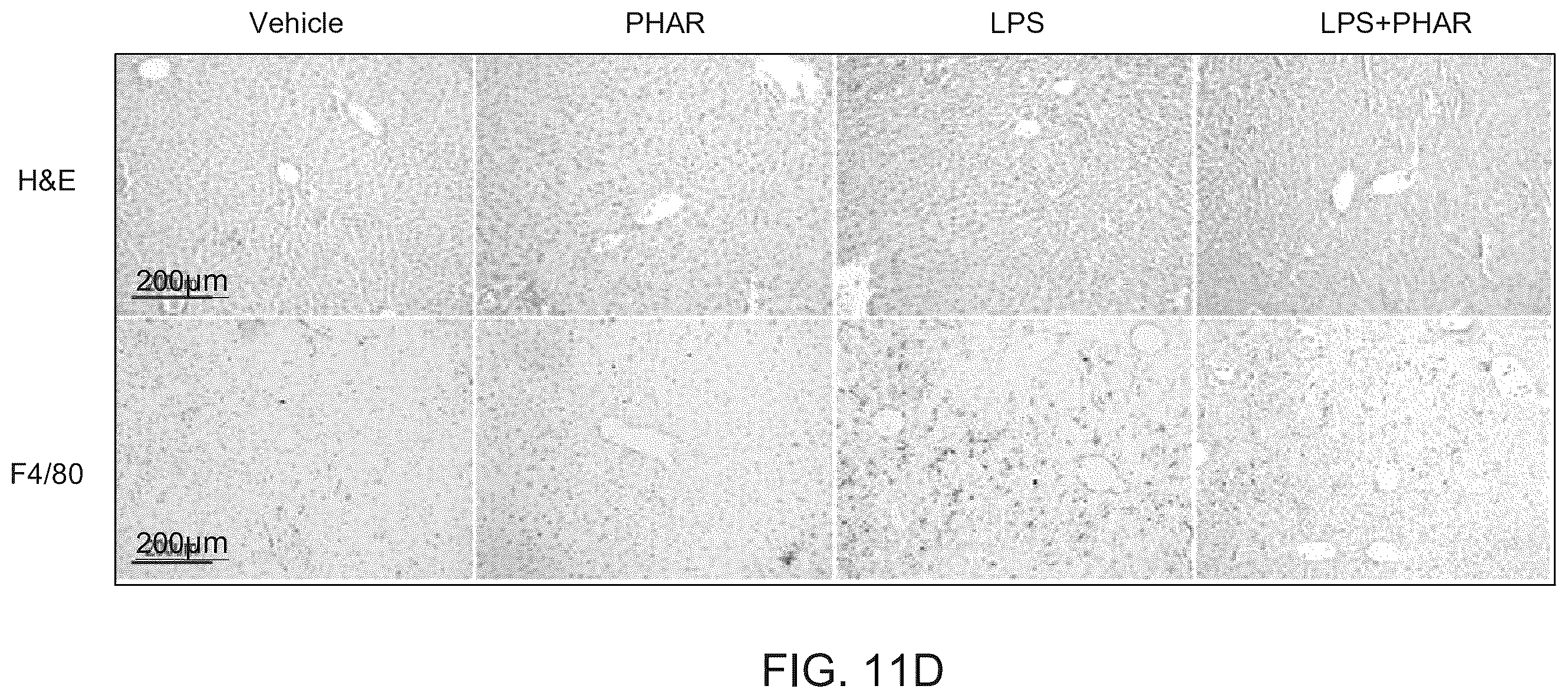 Patent US12590100 Figure 18 – Tetrahydro-spiroindoline-pyrrolopyrrole-triones inhibitors of the NRF2-β-TrCP interaction for use in the treatment of fatty liver disease