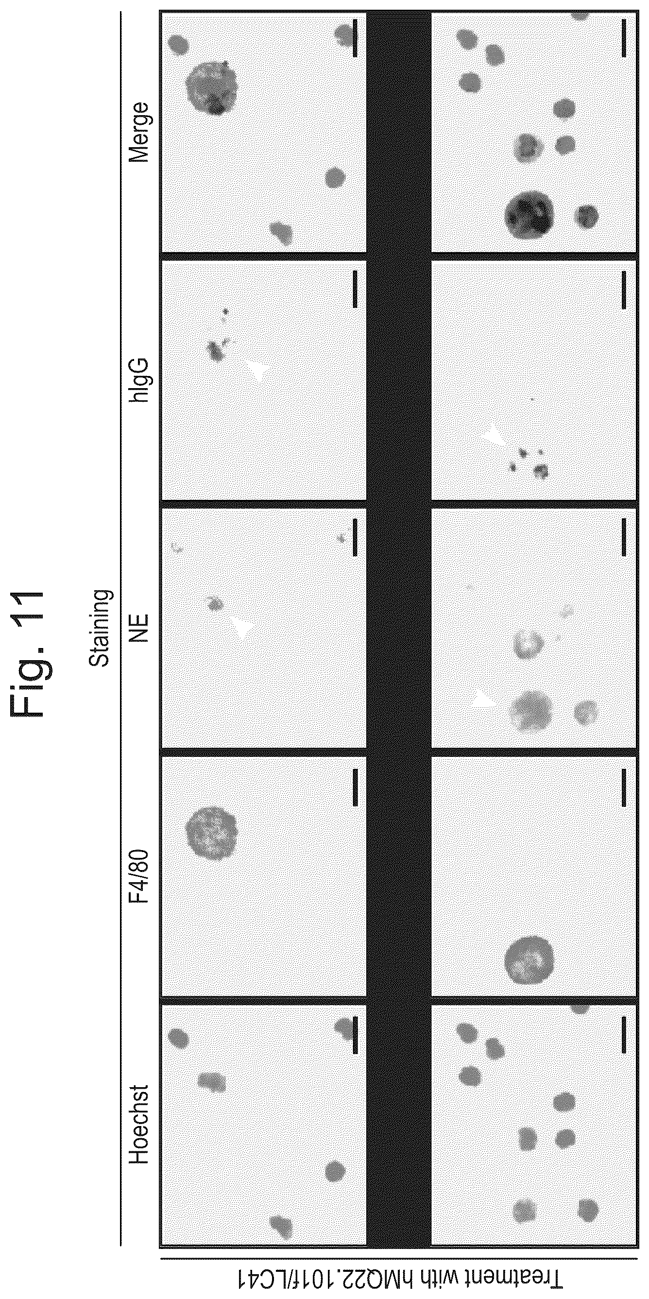 Patent US12590143 Figure 11 – Antibodies binding to citrullinated histone 2A and/or 4
