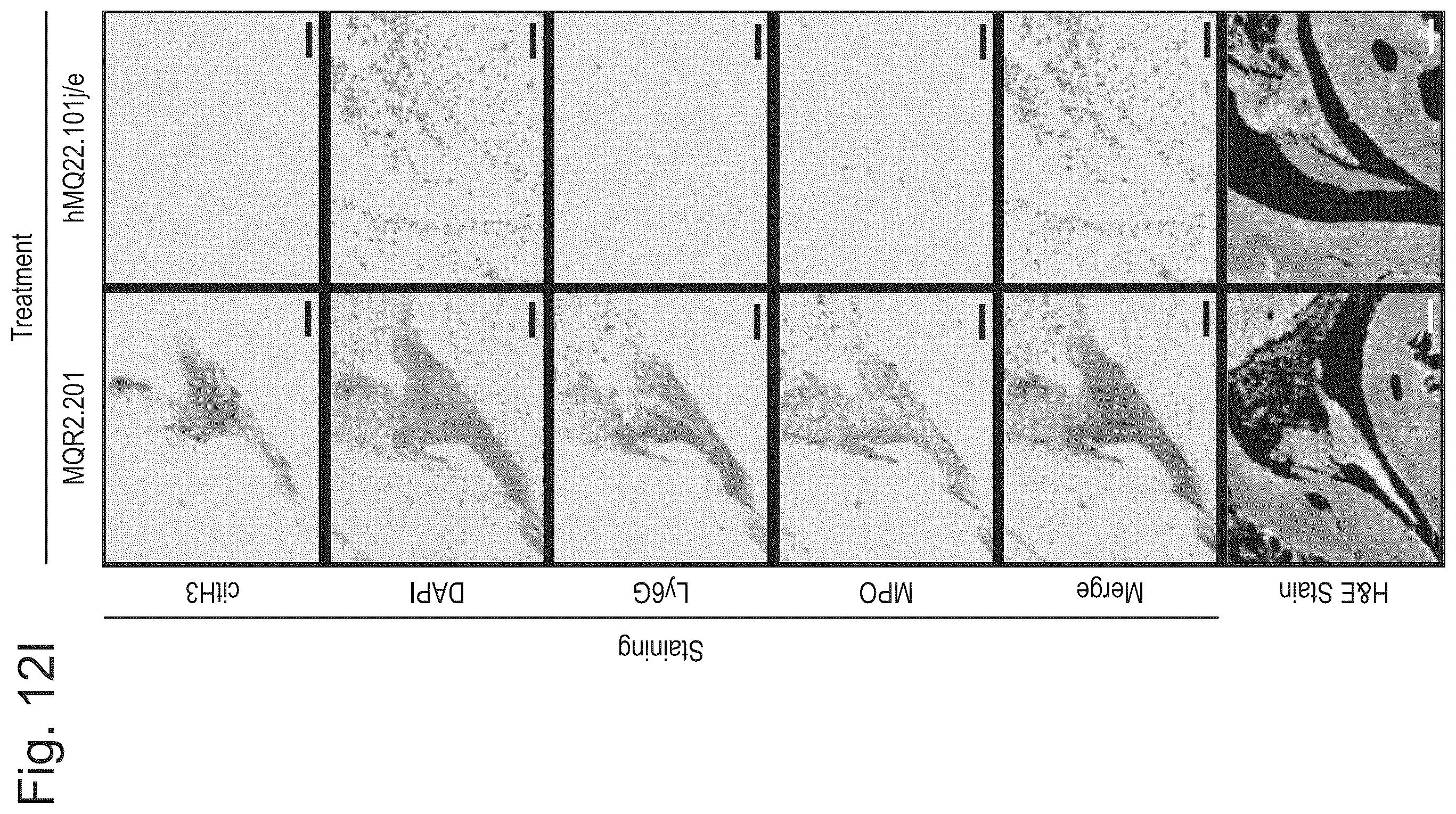 Patent US12590143 Figure 14 – Antibodies binding to citrullinated histone 2A and/or 4