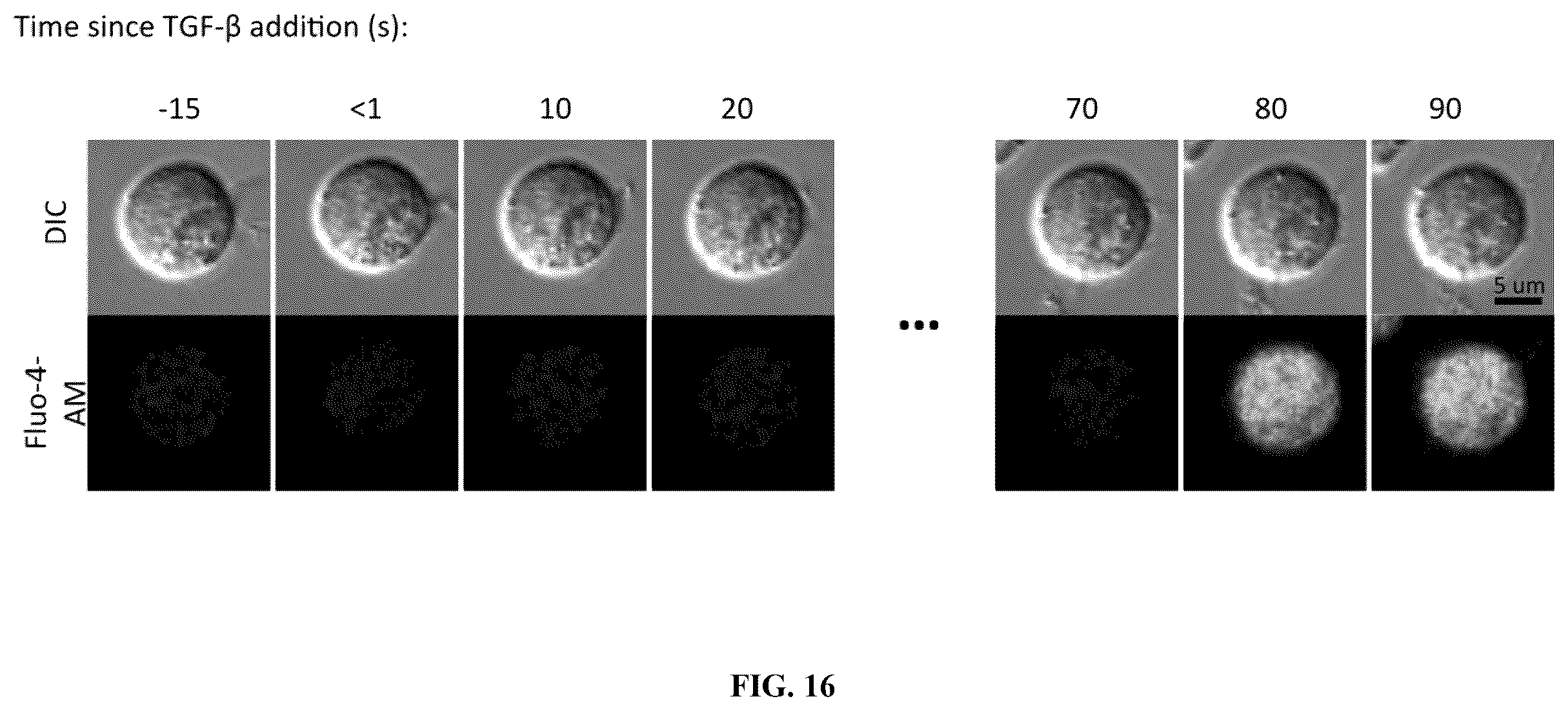 Patent US12590145 Figure 16 – Bi-specific chimeric antigen receptor