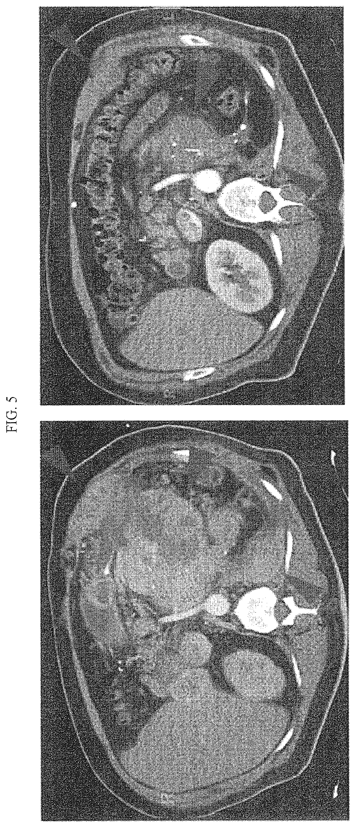 Patent US12590154 Figure 12 – Cancer immunotherapy by disrupting PD-1/PD-L1 signaling
