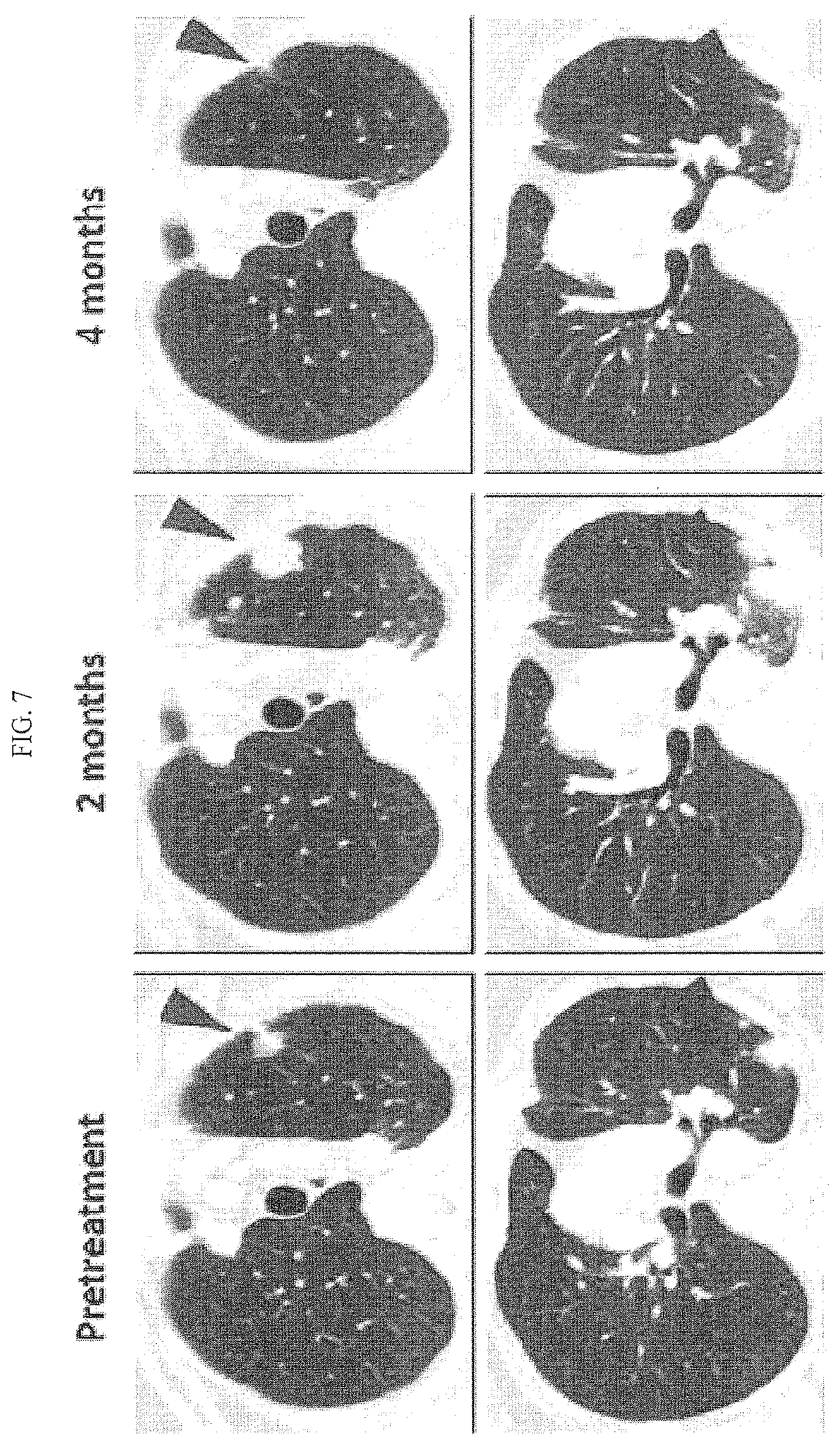 Patent US12590154 Figure 14 – Cancer immunotherapy by disrupting PD-1/PD-L1 signaling