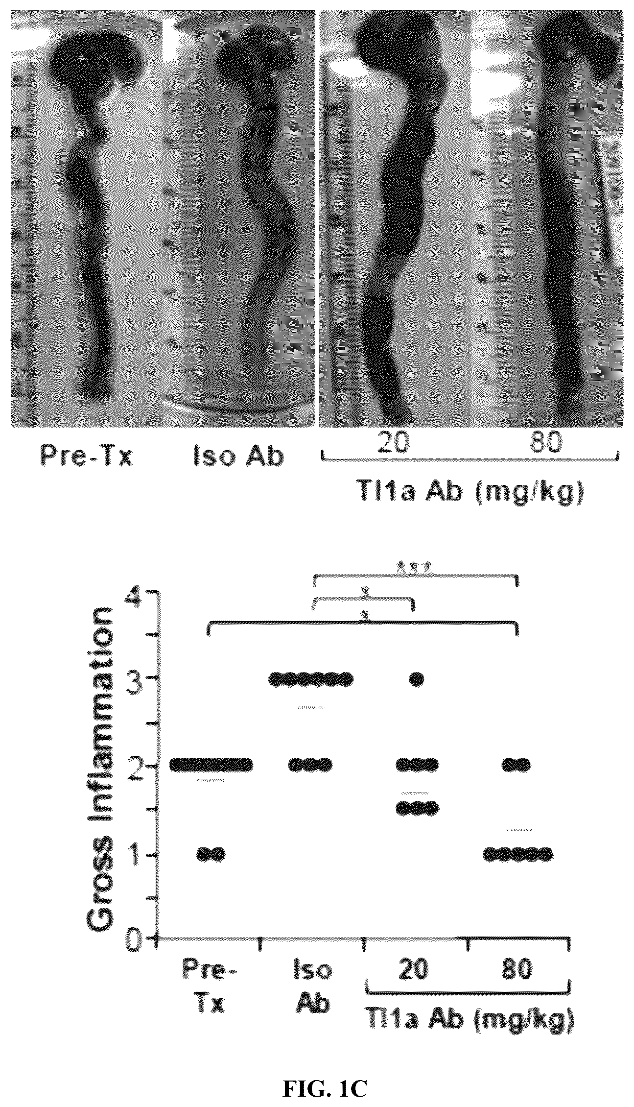 Patent US12590160 Figure 2 – Mitigation and reversal of intestinal fibrosis and inflammation by inhibition of TL1A function