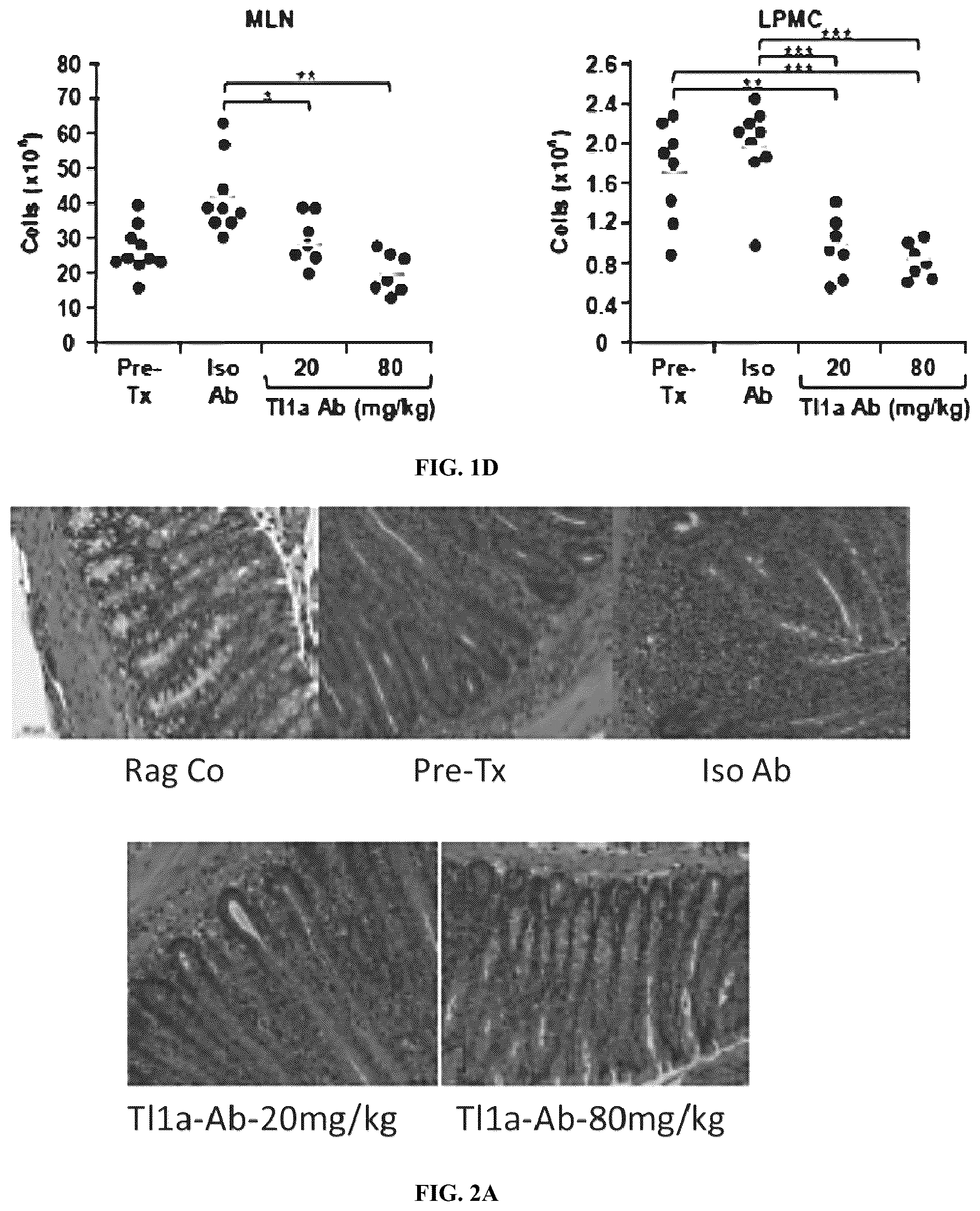 Patent US12590160 Figure 3 – Mitigation and reversal of intestinal fibrosis and inflammation by inhibition of TL1A function