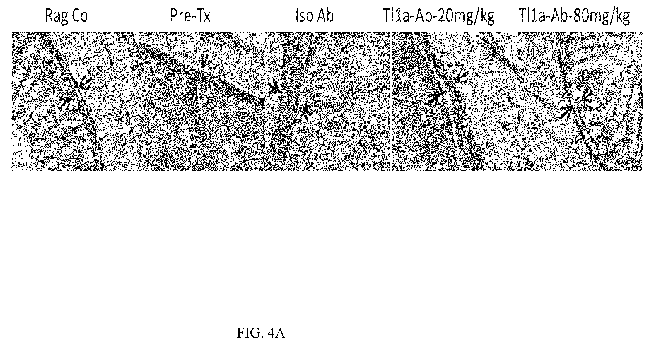Patent US12590160 Figure 9 – Mitigation and reversal of intestinal fibrosis and inflammation by inhibition of TL1A function