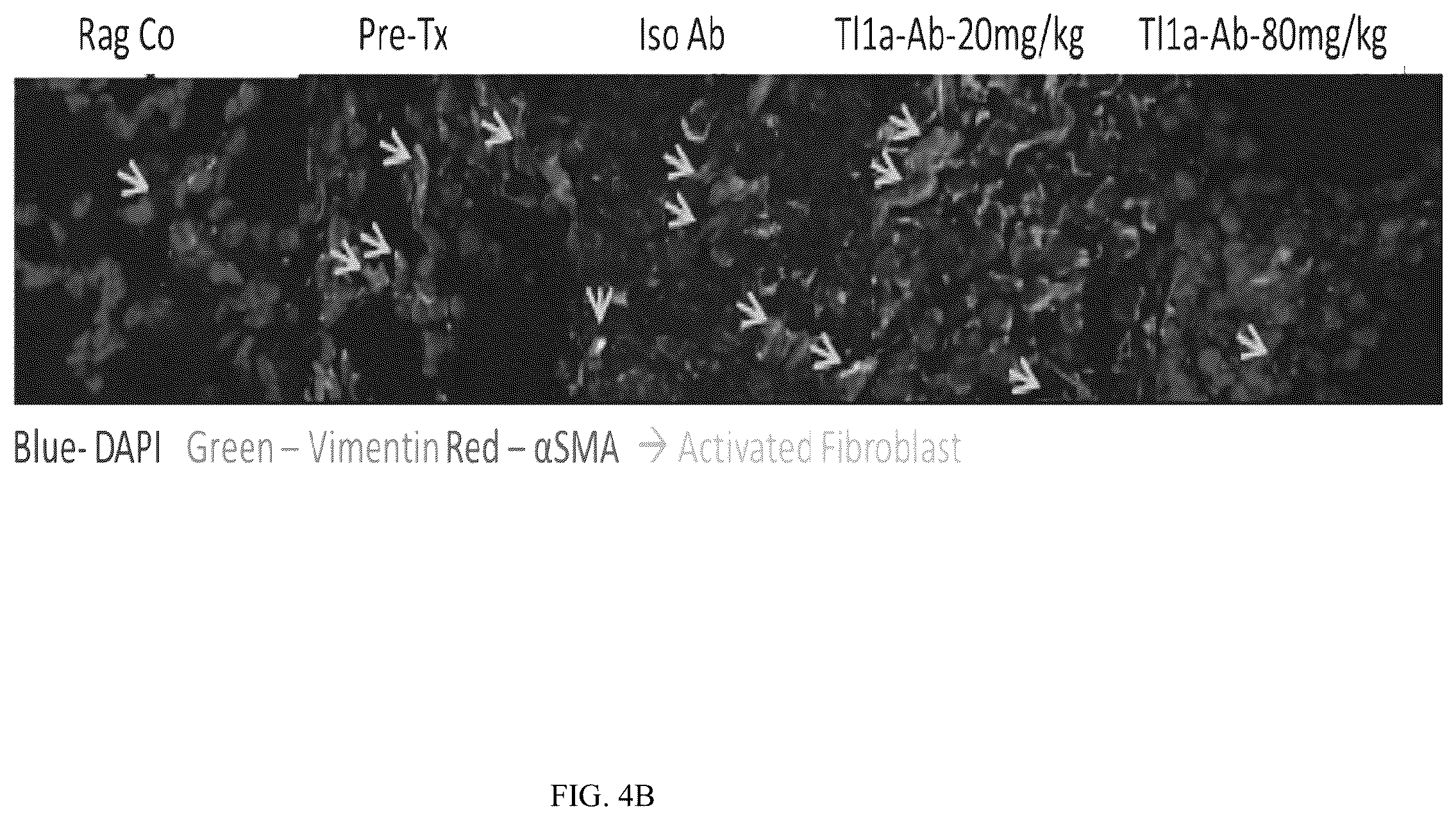 Patent US12590160 Figure 10 – Mitigation and reversal of intestinal fibrosis and inflammation by inhibition of TL1A function