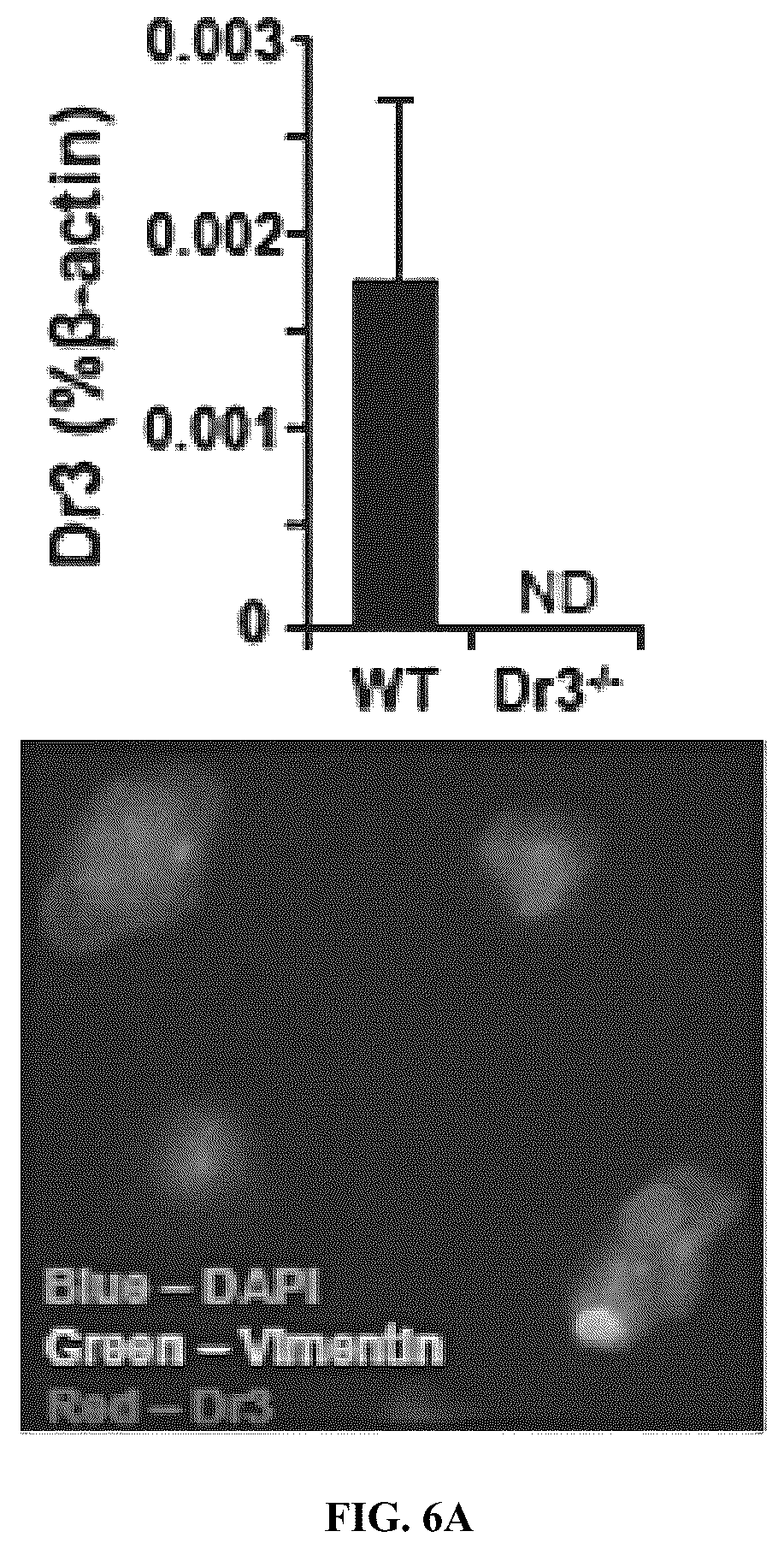 Patent US12590160 Figure 14 – Mitigation and reversal of intestinal fibrosis and inflammation by inhibition of TL1A function
