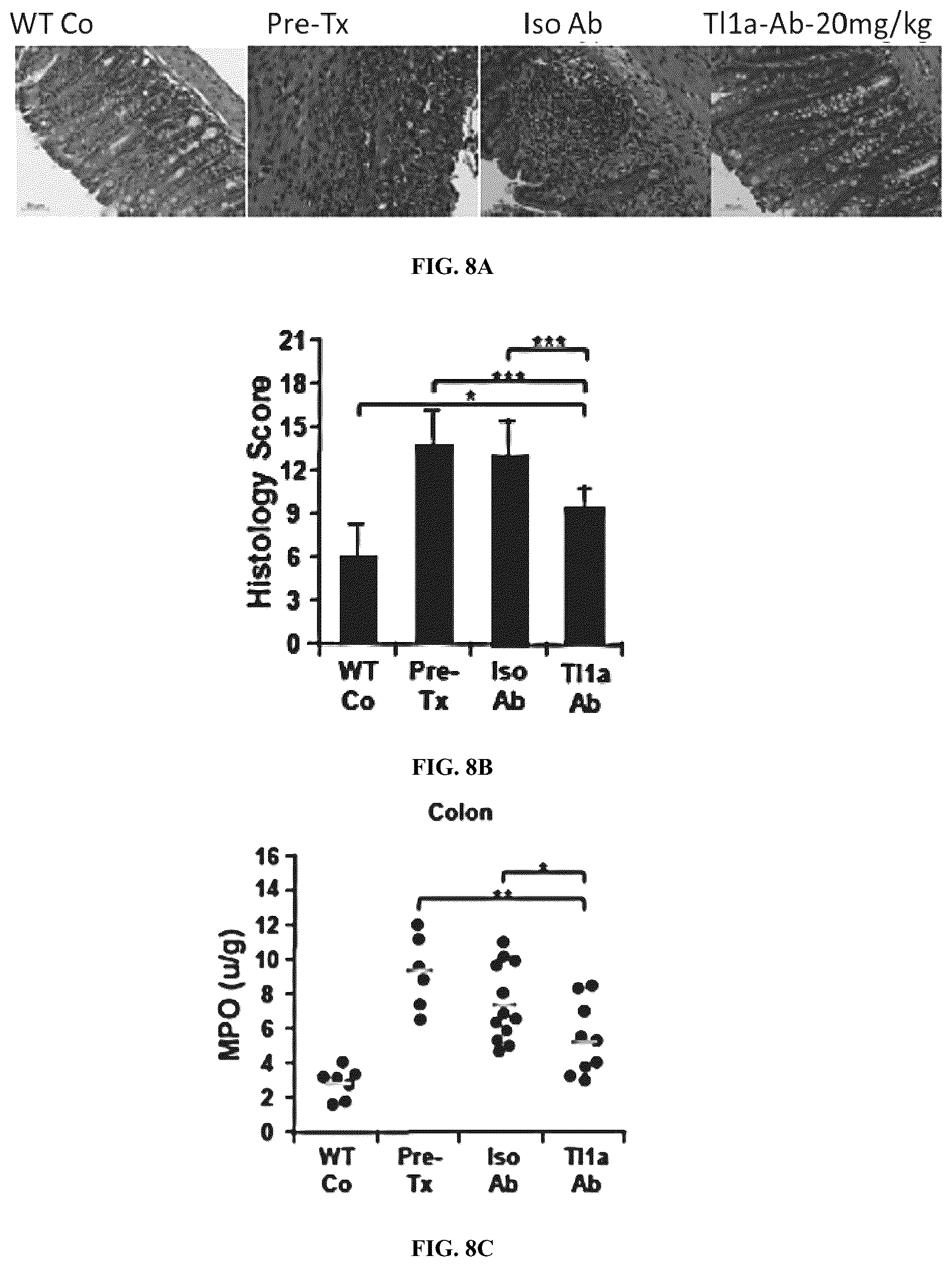 Patent US12590160 Figure 18 – Mitigation and reversal of intestinal fibrosis and inflammation by inhibition of TL1A function