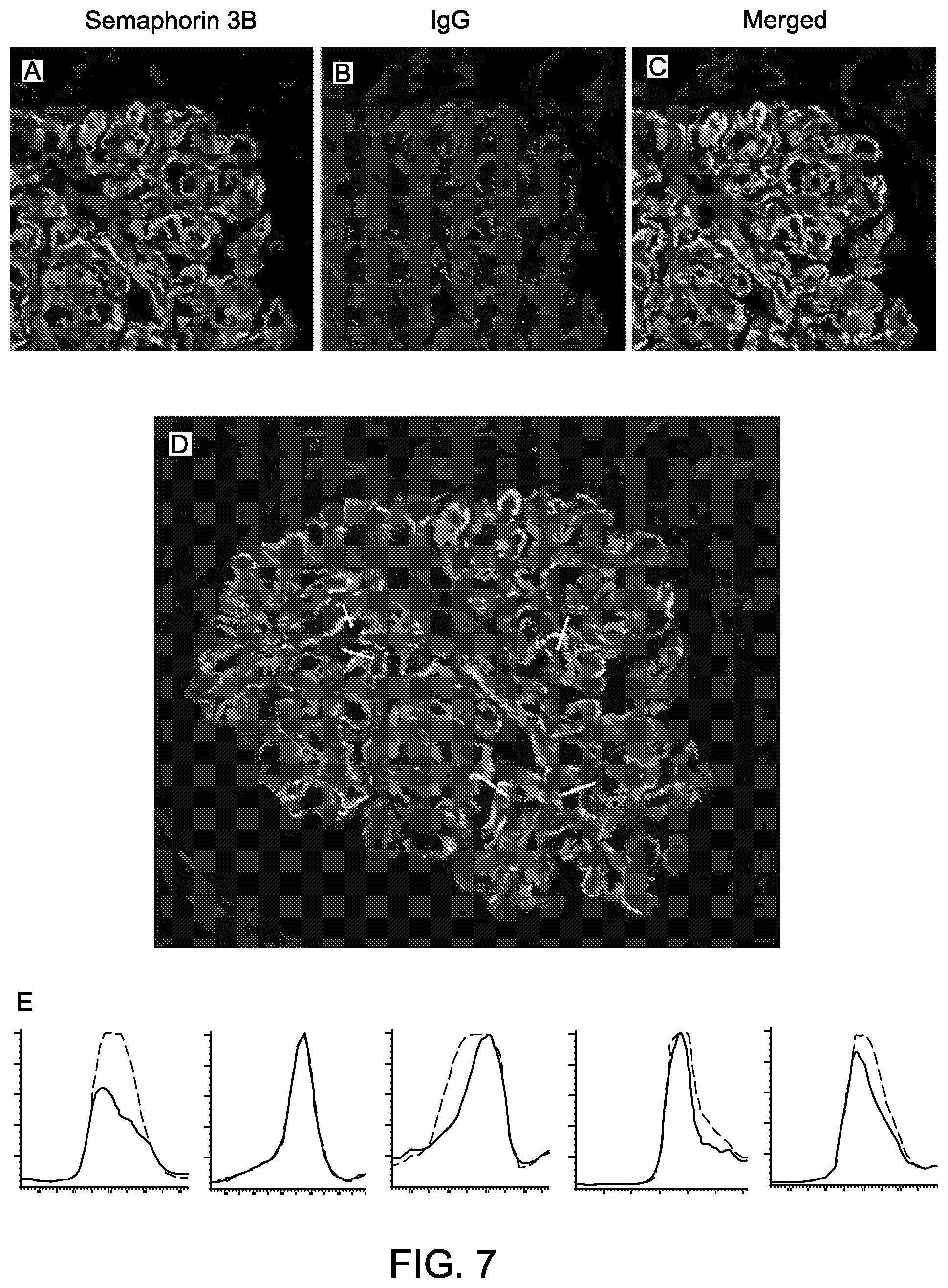 Patent US12590165 Figure 9 – Methods and materials for identifying and treating membranous nephropathy based on elevated Semaphorin 3B