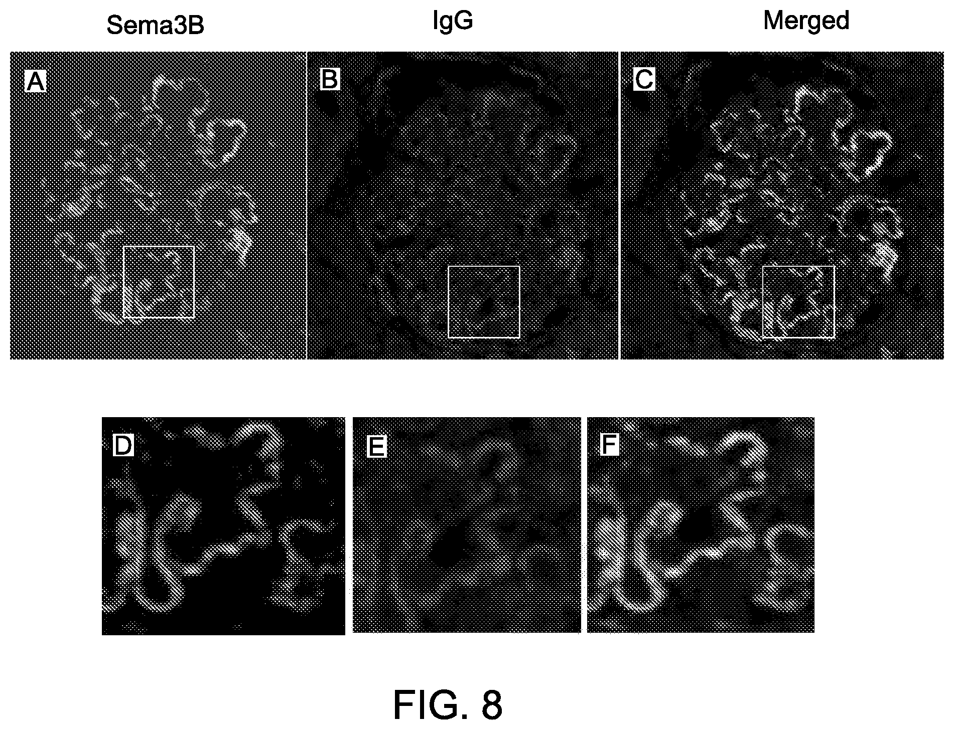 Patent US12590165 Figure 10 – Methods and materials for identifying and treating membranous nephropathy based on elevated Semaphorin 3B