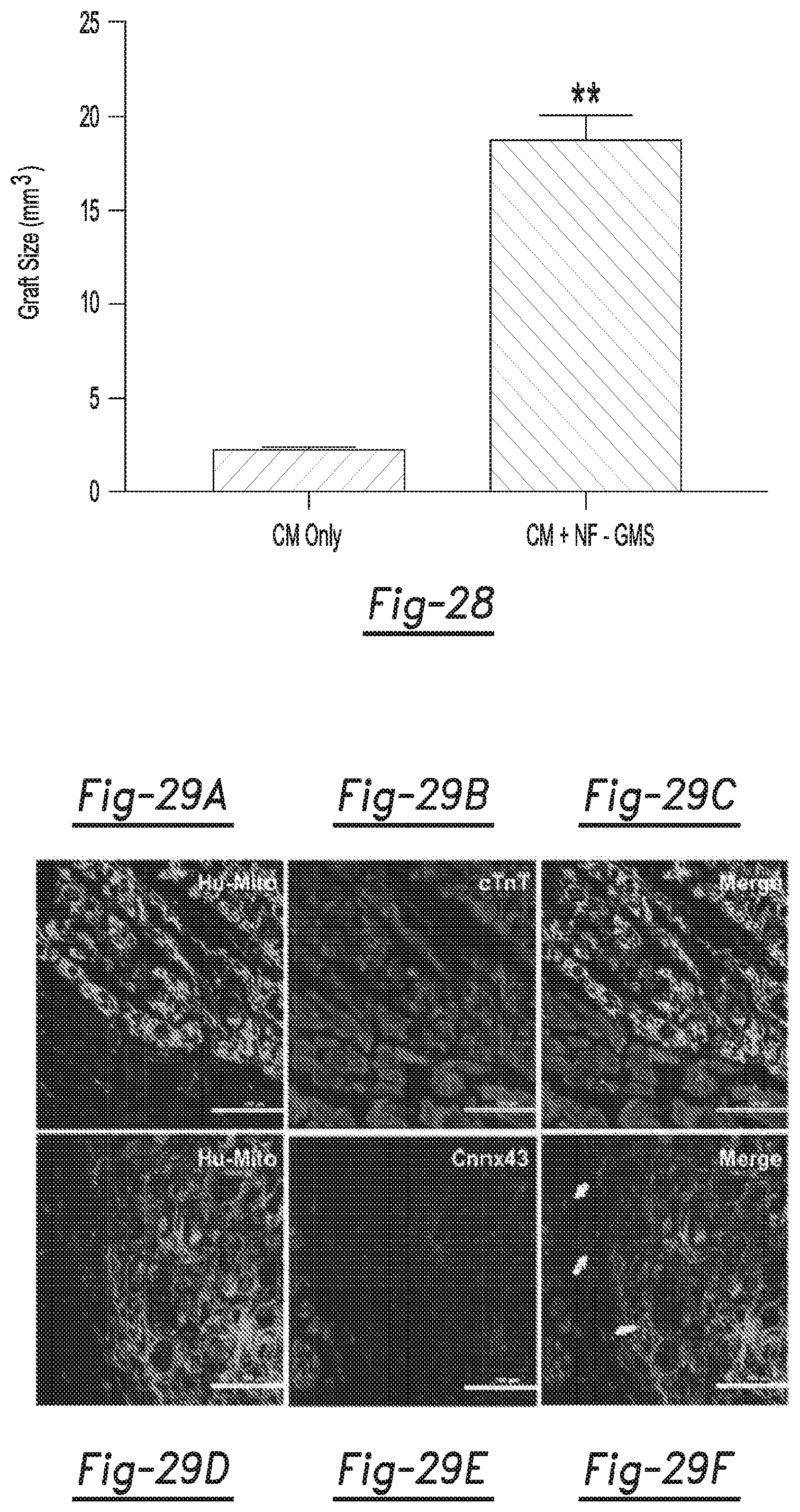 Patent US12590188 Figure 15 – Tri-block copolymers and nano-fibrous gelling microspheres including the same