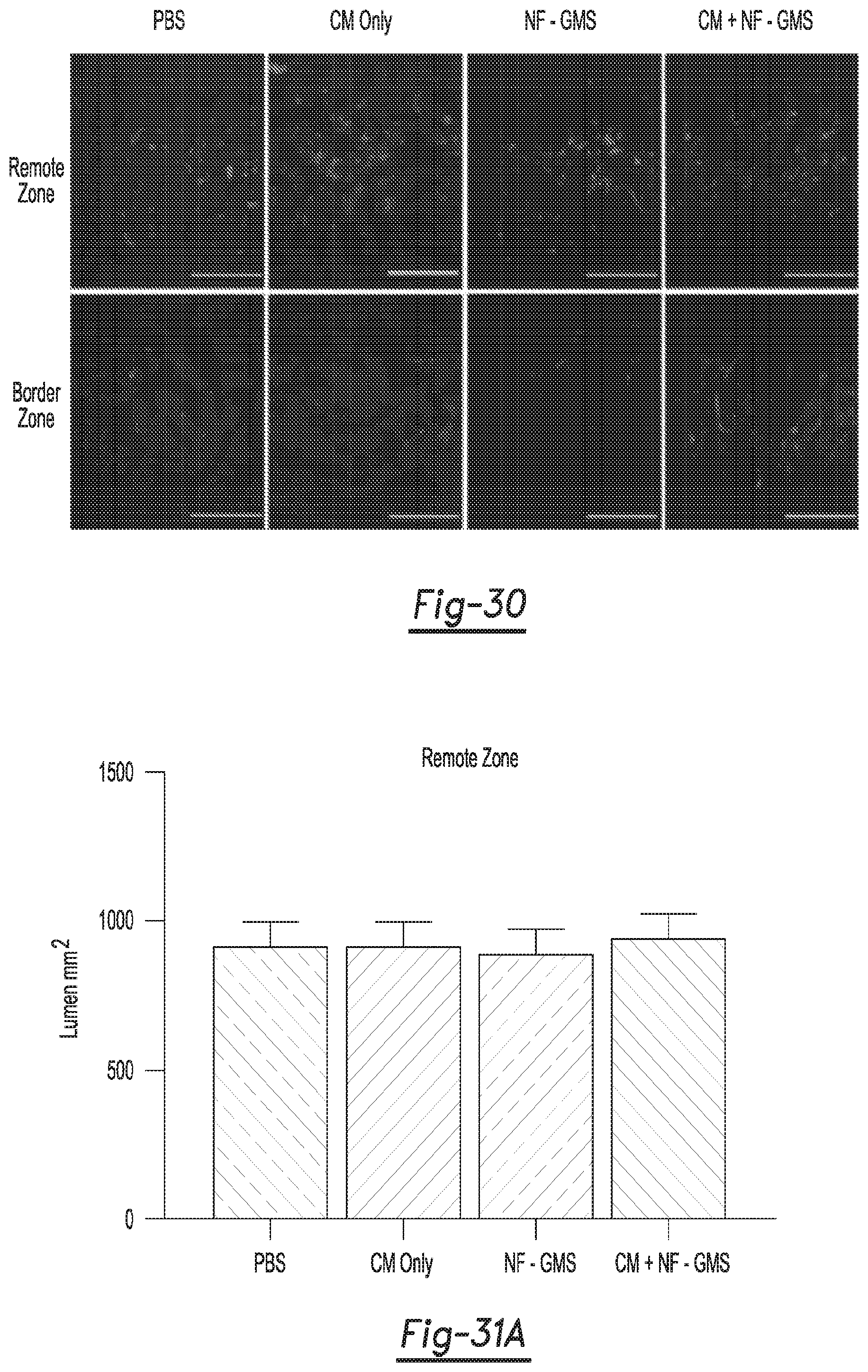 Patent US12590188 Figure 16 – Tri-block copolymers and nano-fibrous gelling microspheres including the same