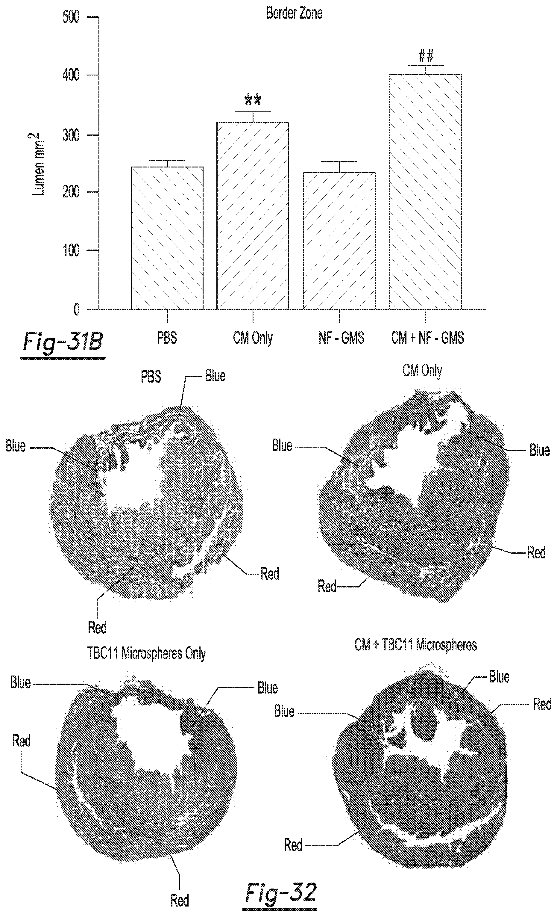 Patent US12590188 Figure 17 – Tri-block copolymers and nano-fibrous gelling microspheres including the same