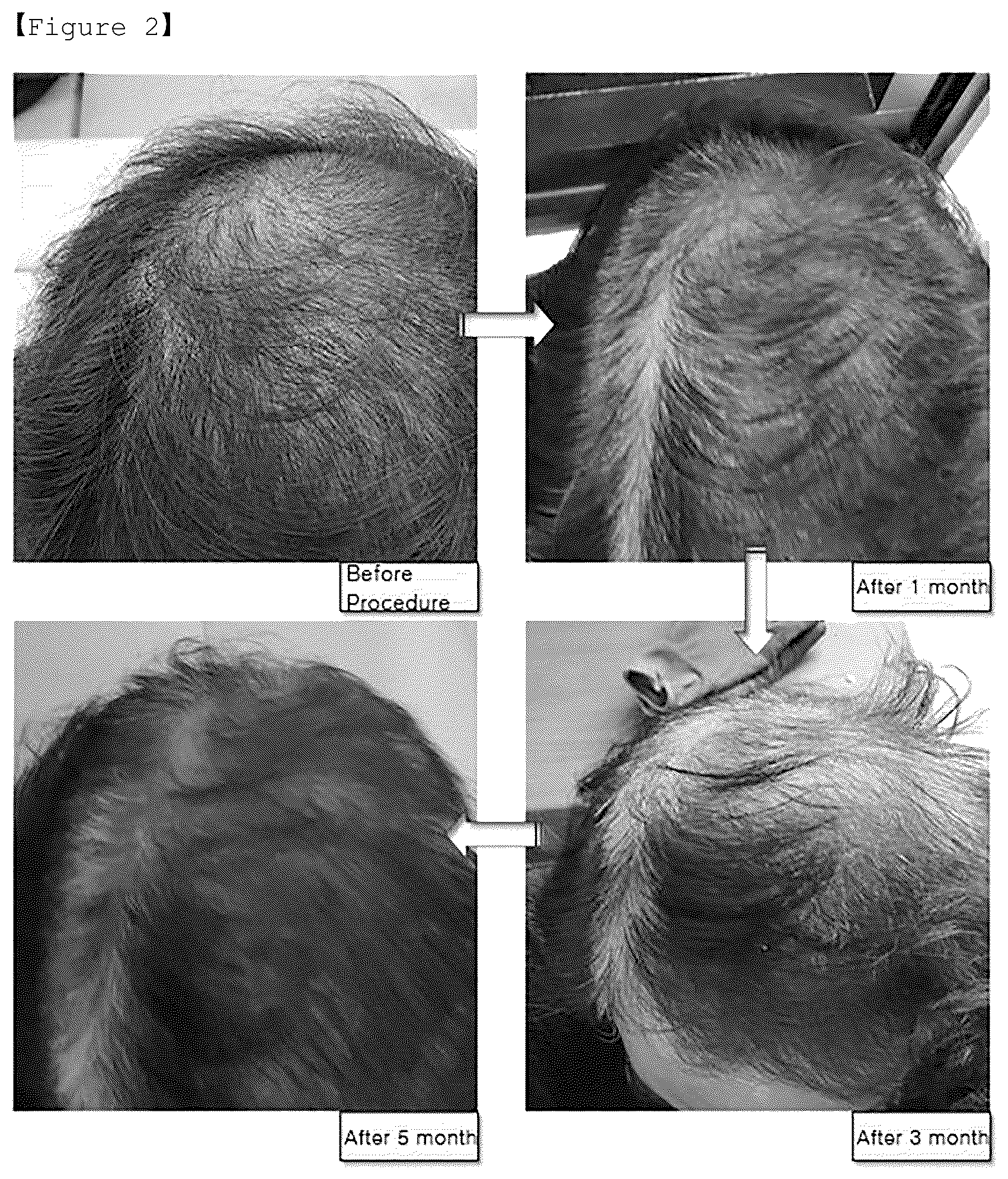 Patent US12590286 Figure 2 – Method for preparing agent for prevention of hair loss and promotion of hair regrowth through fusion fermentation of lactic acid bacteria
