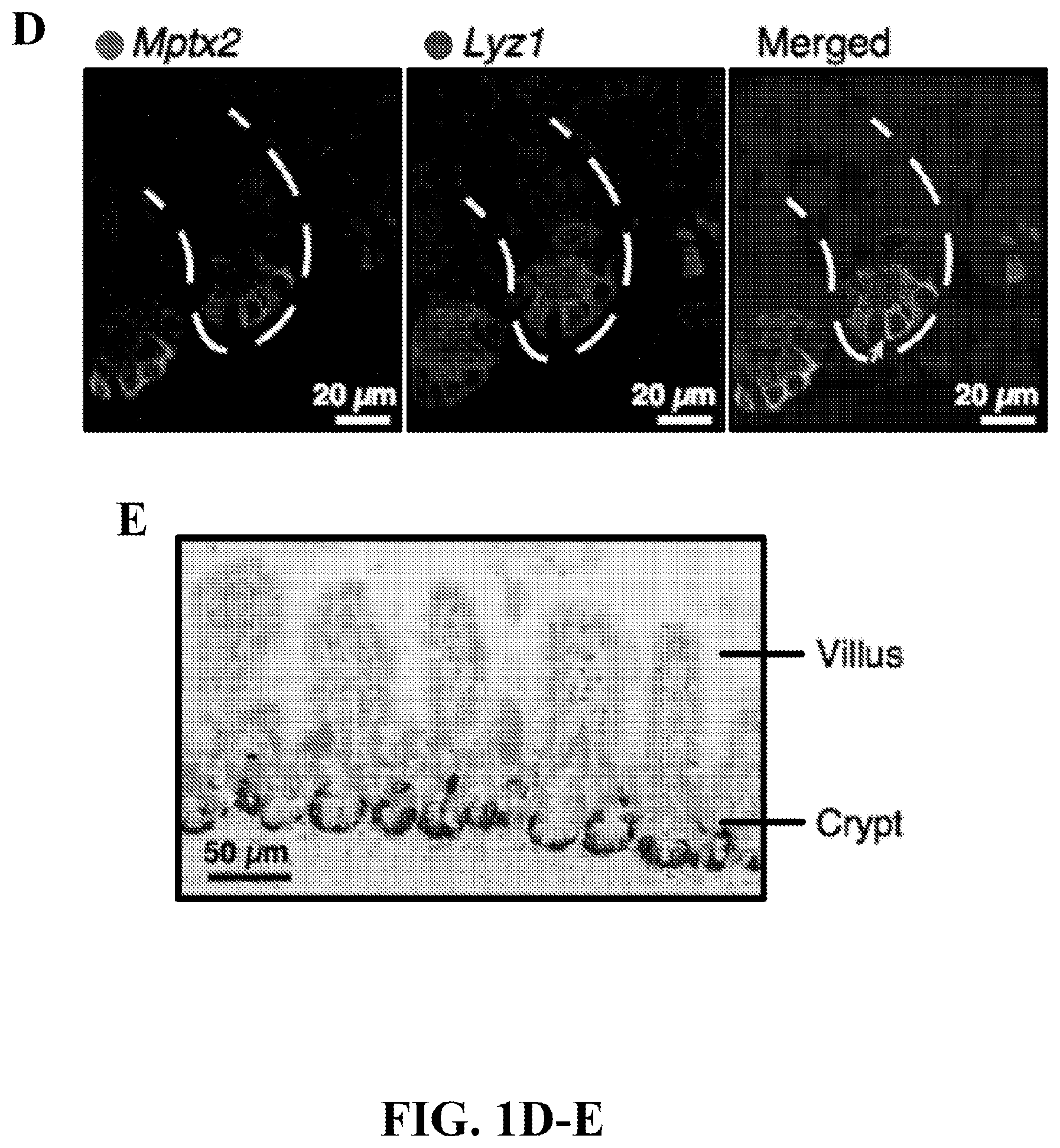 Patent US12590288 Figure 4 – Method of treating an inflammatory disease by administering an agent which binds a surface receptor on a tuft cell that induces an ILC class 2 inflammatory response