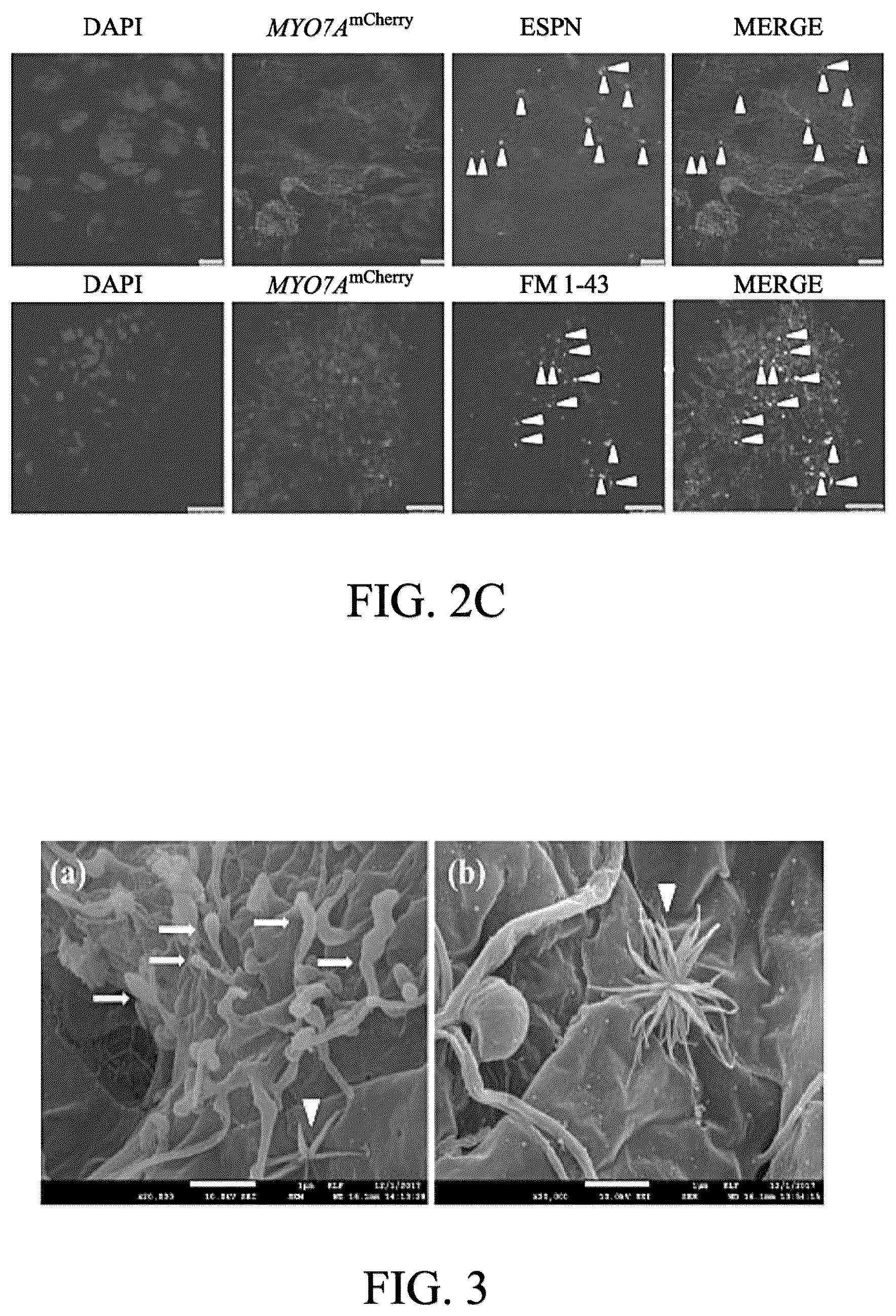 Patent US12590290 Figure 4 – Method for treating and modelling hearing loss
