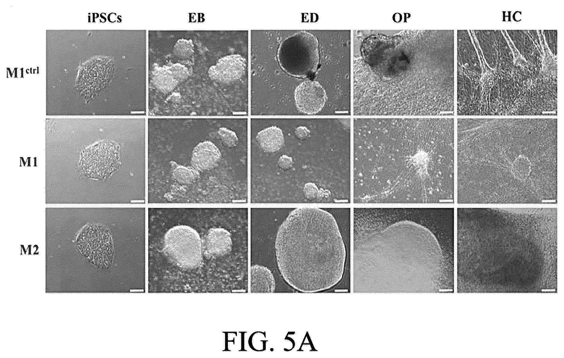 Patent US12590290 Figure 8 – Method for treating and modelling hearing loss