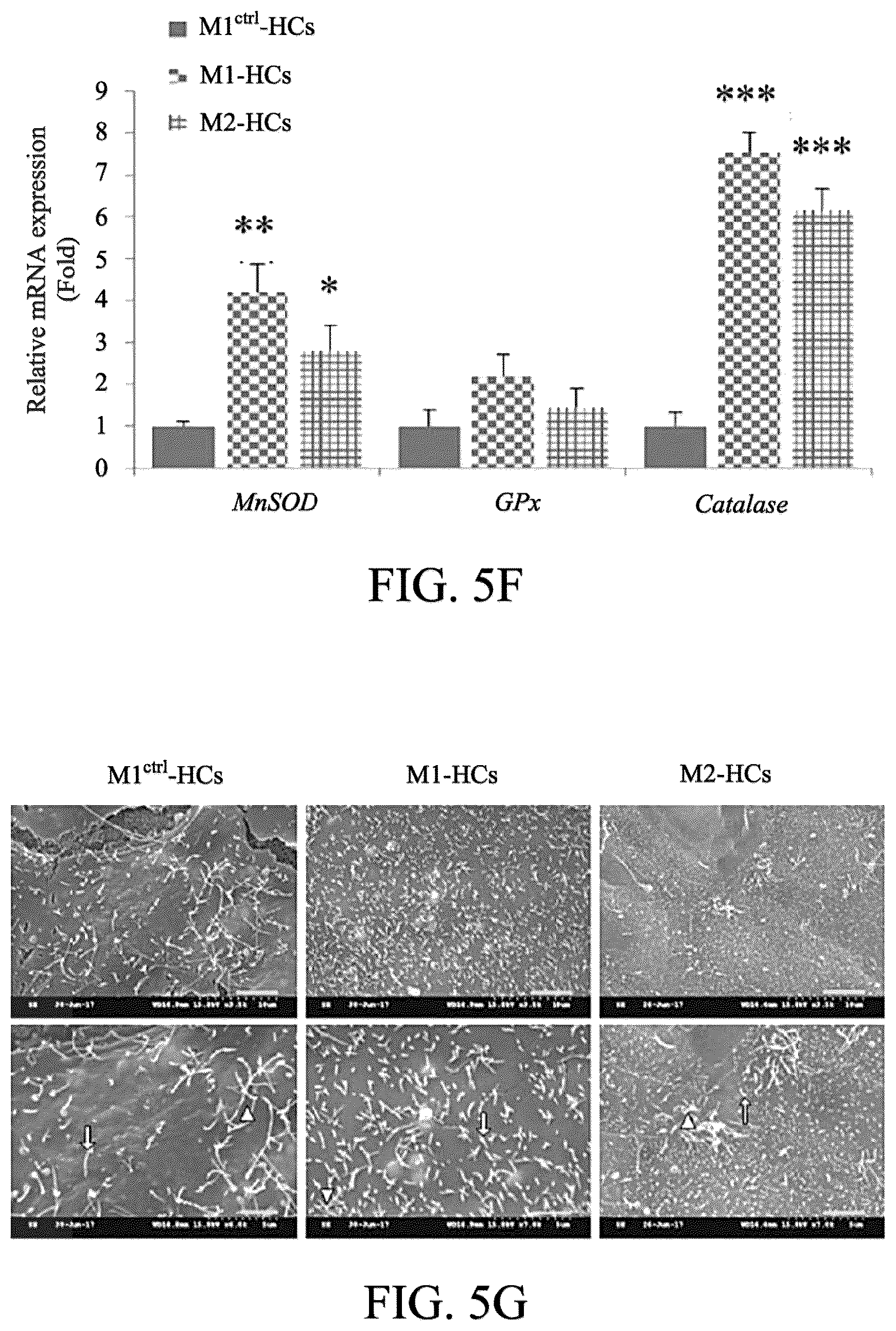 Patent US12590290 Figure 13 – Method for treating and modelling hearing loss