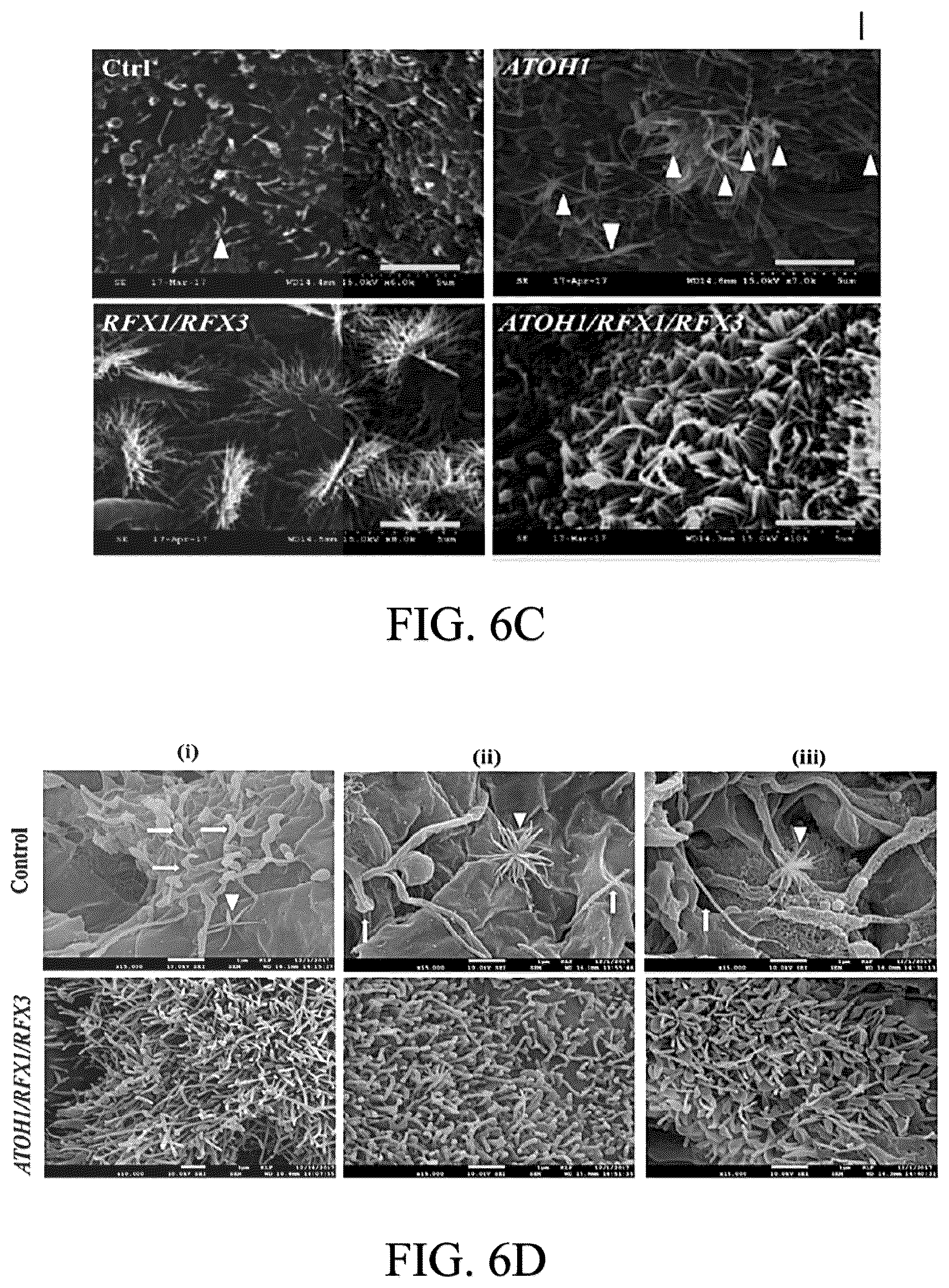 Patent US12590290 Figure 17 – Method for treating and modelling hearing loss