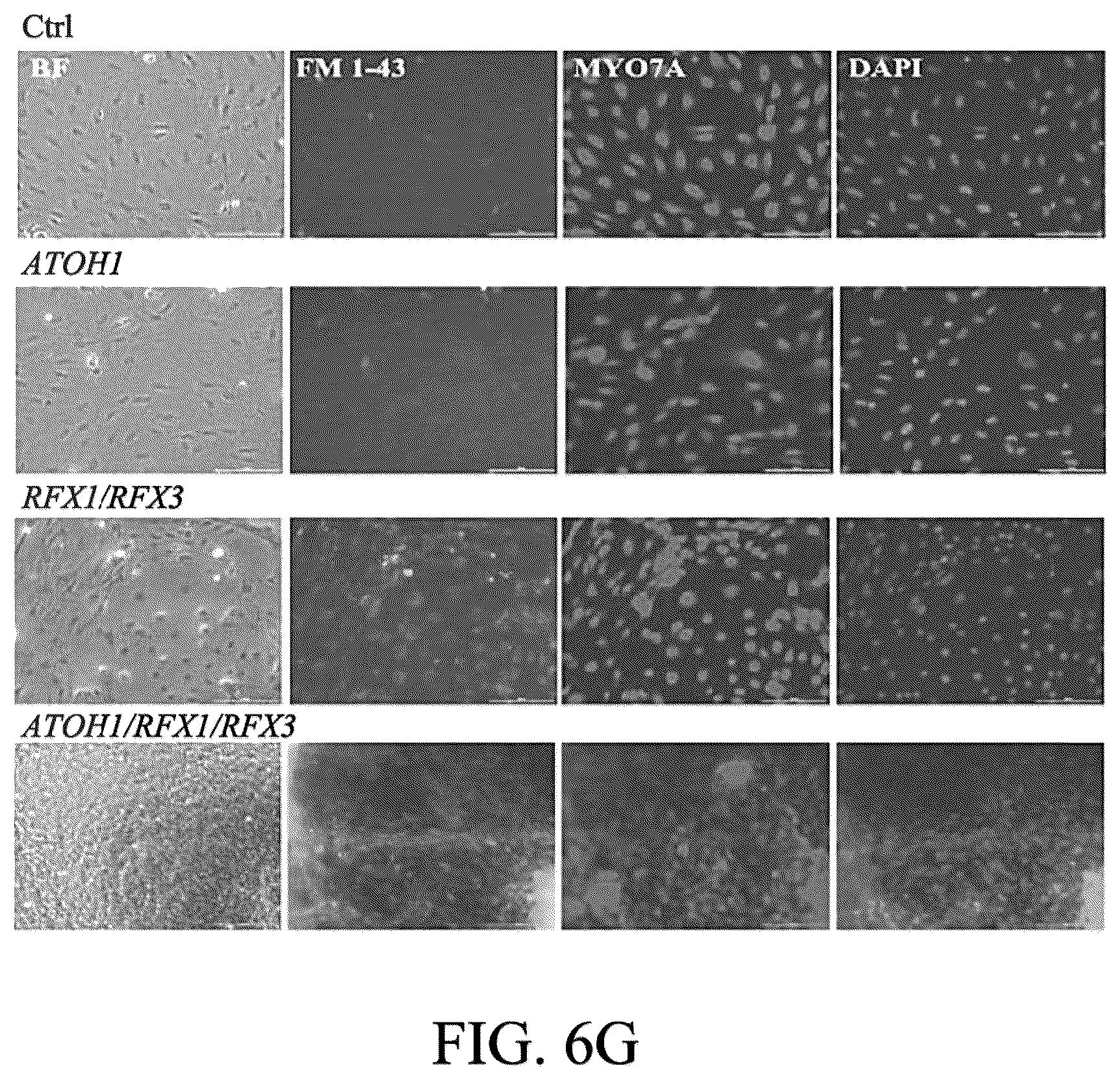 Patent US12590290 Figure 19 – Method for treating and modelling hearing loss
