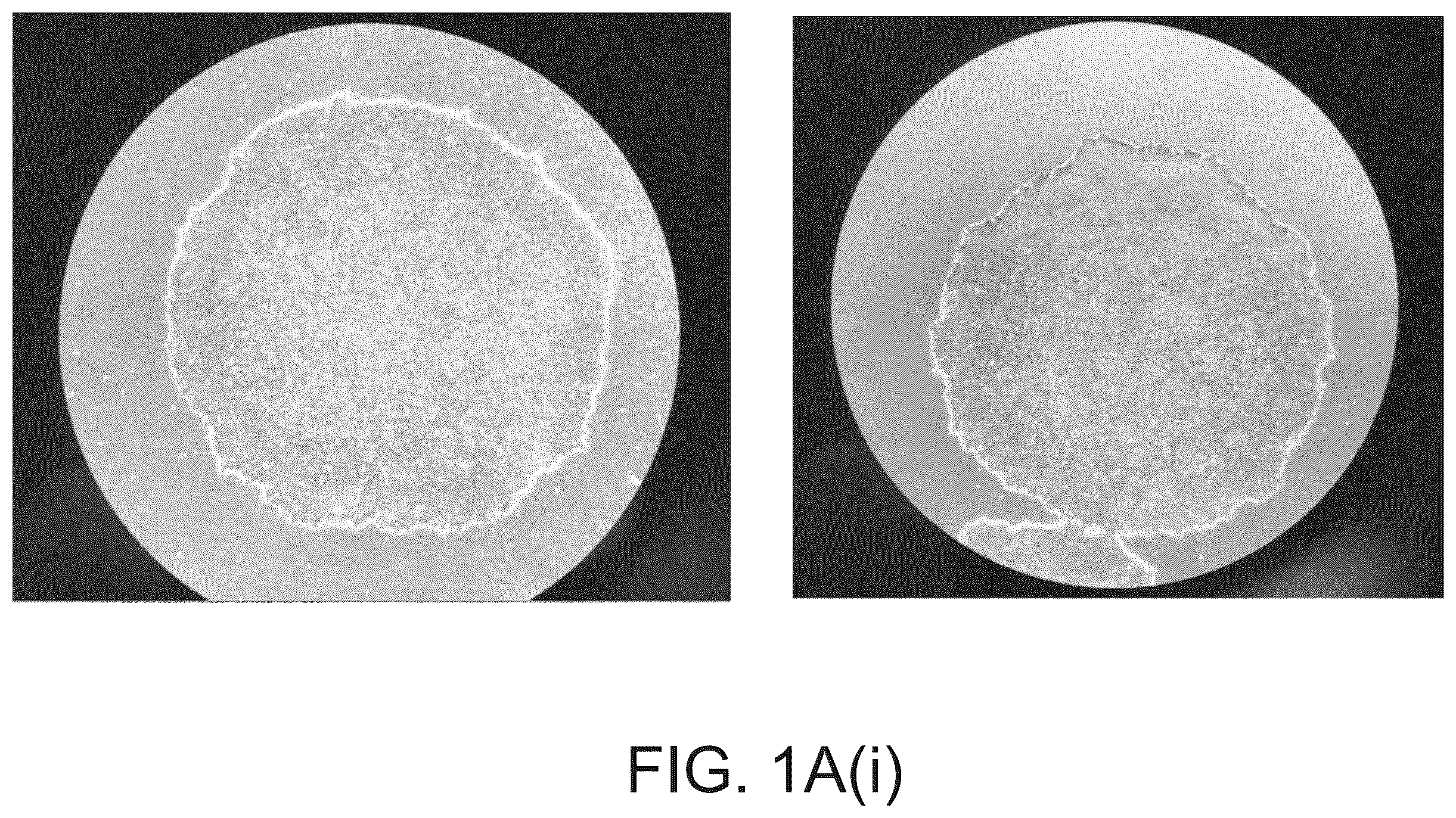 Patent US12590320 Figure 1 – Cellular models of and therapies for ocular diseases