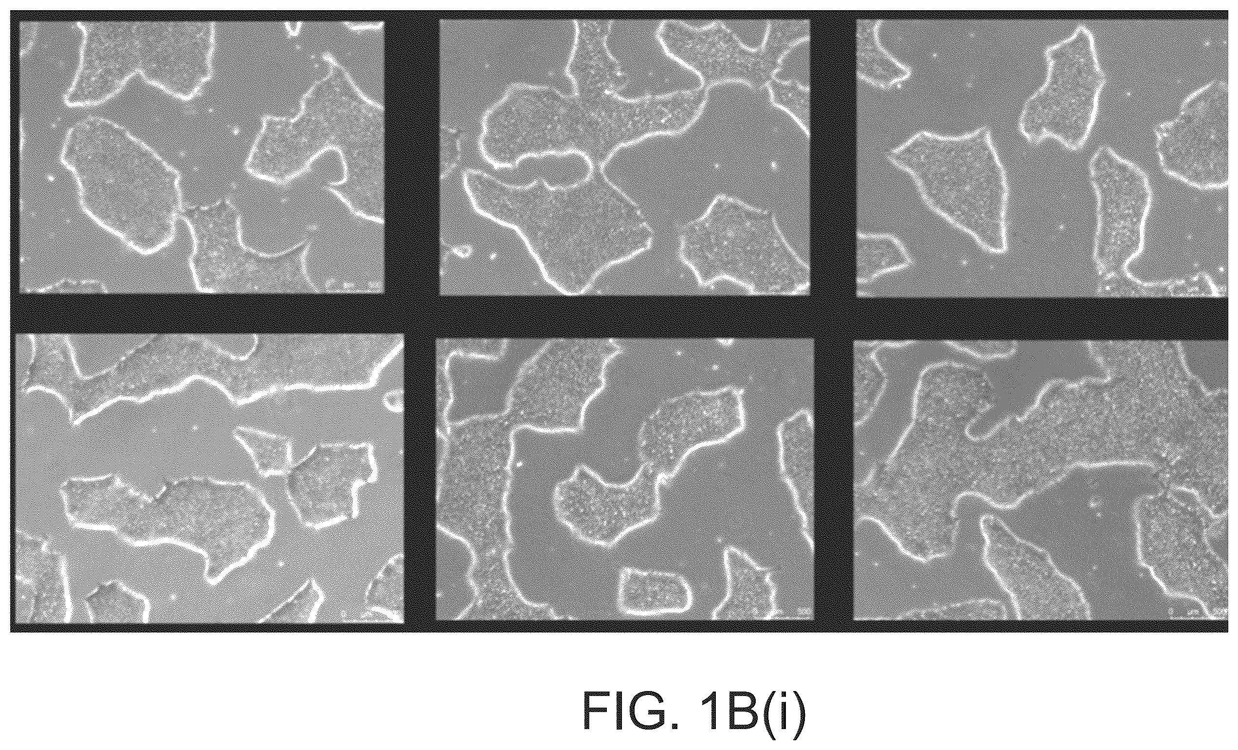 Patent US12590320 Figure 5 – Cellular models of and therapies for ocular diseases