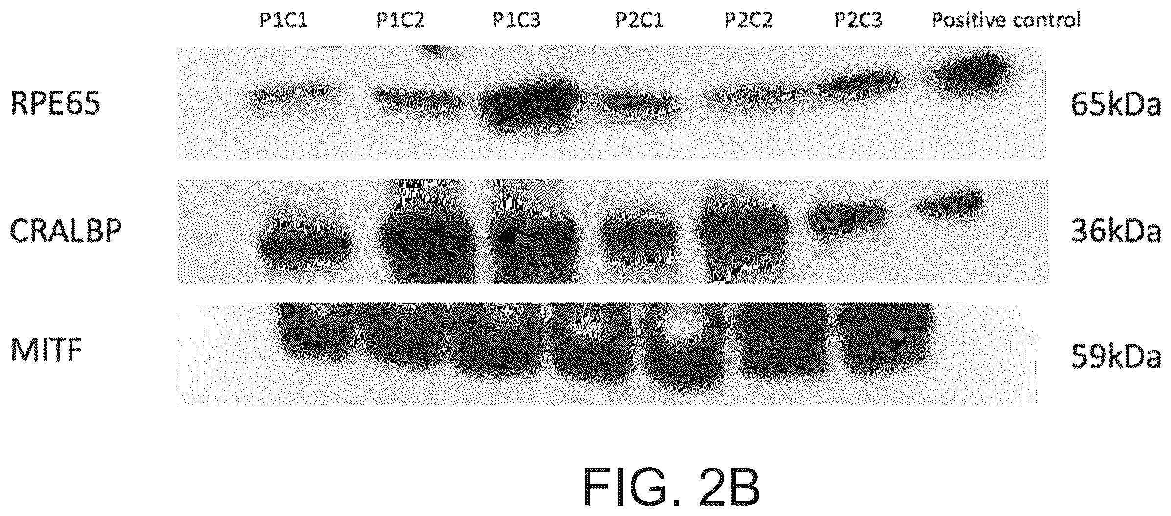 Patent US12590320 Figure 10 – Cellular models of and therapies for ocular diseases