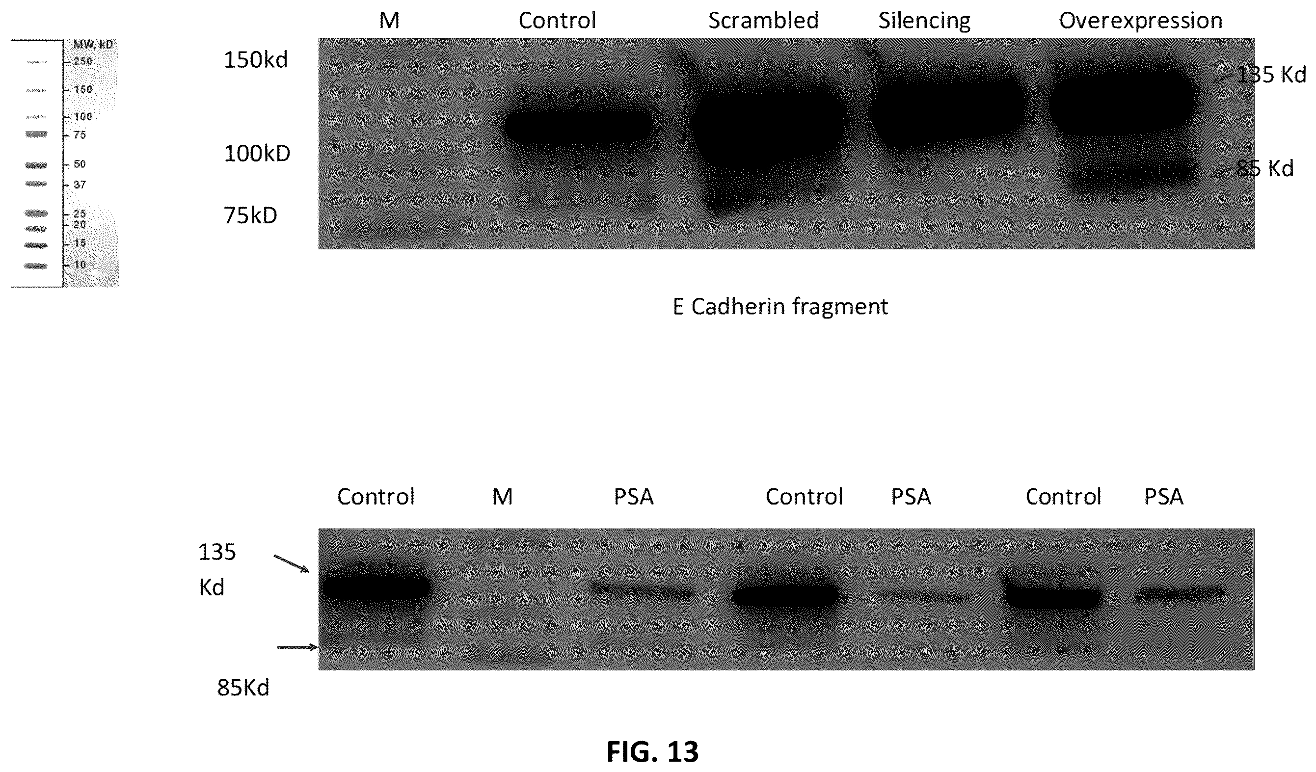 Patent US12590333 Figure 13 – N-Myc-interactor protein as a marker for chronic lung disease and uses thereof