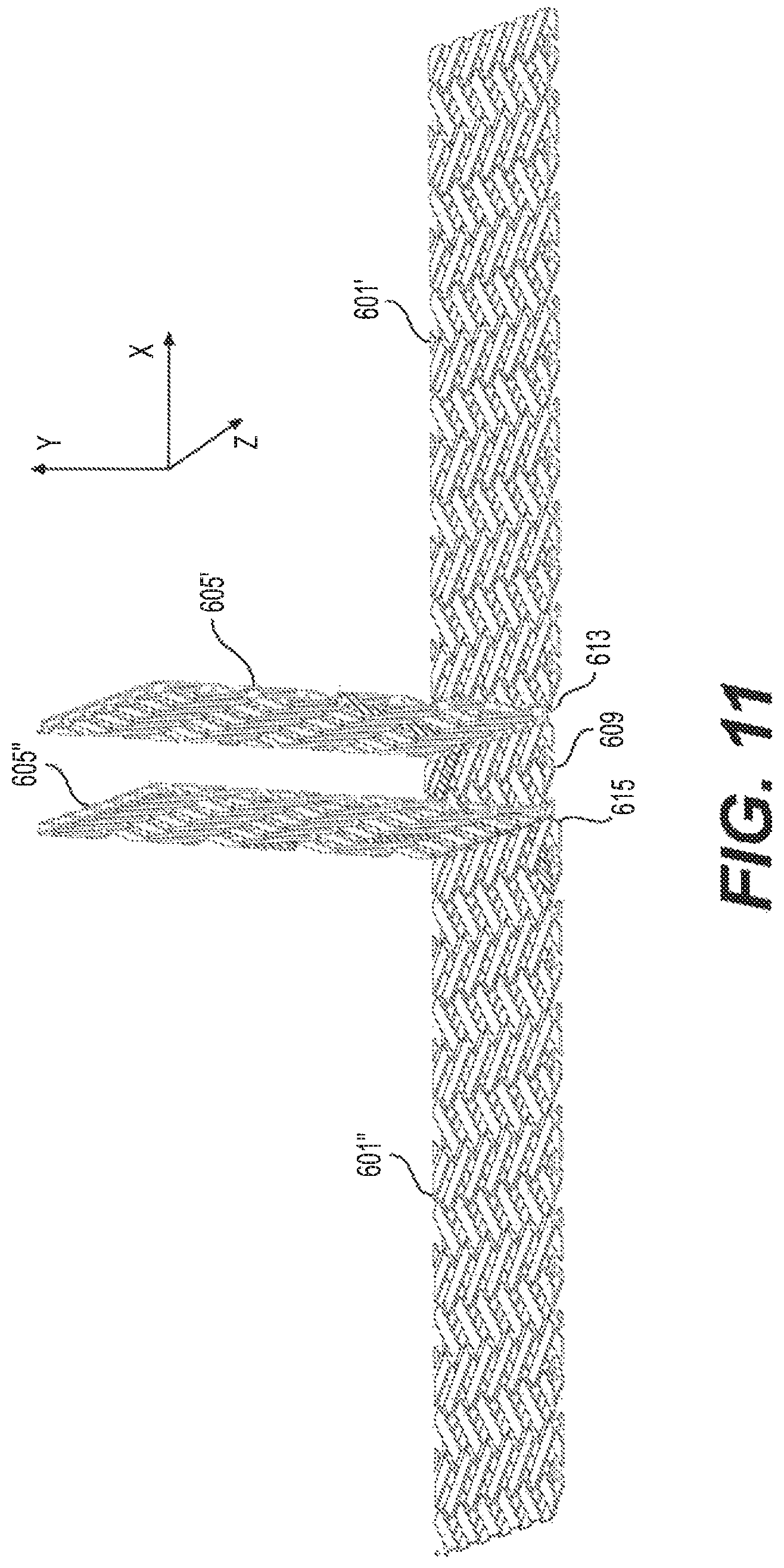 Patent US12590390 Figure 12 – Interlocking braided structures