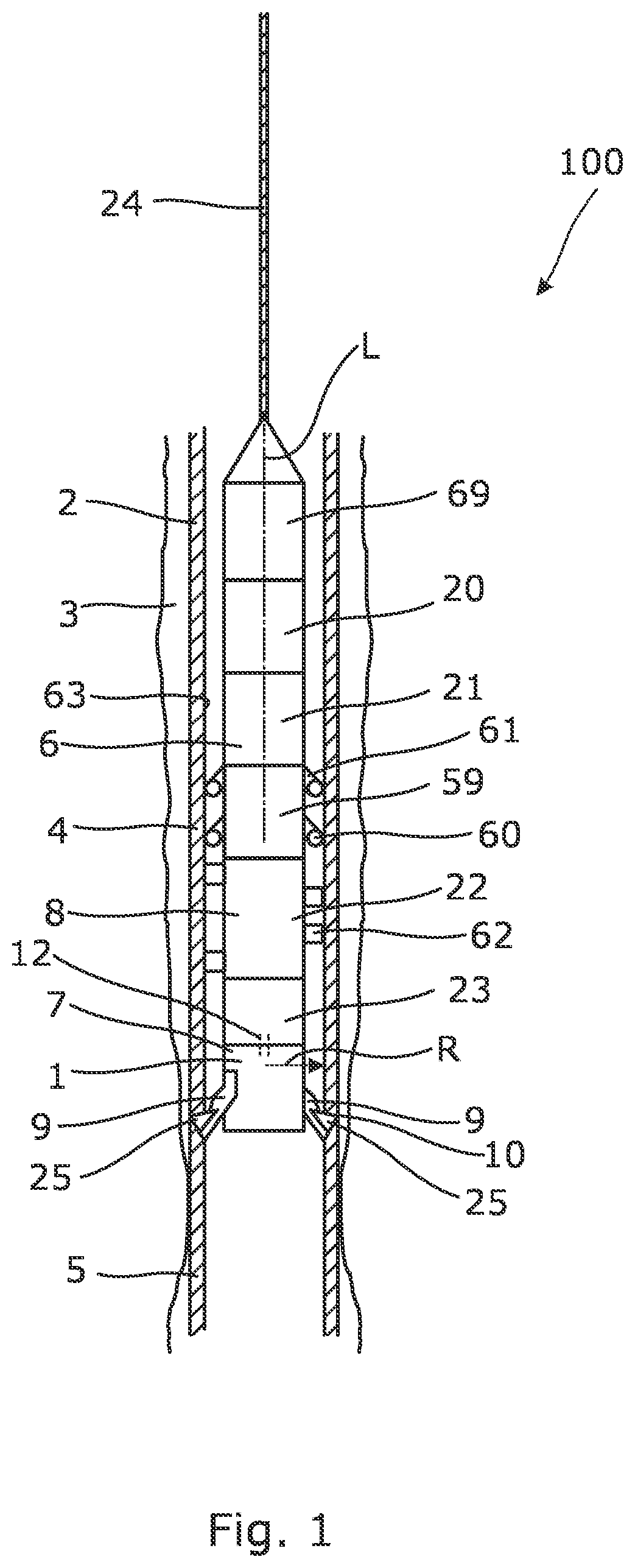Patent US12590499 Figure 1 – Downhole tubing intervention tool