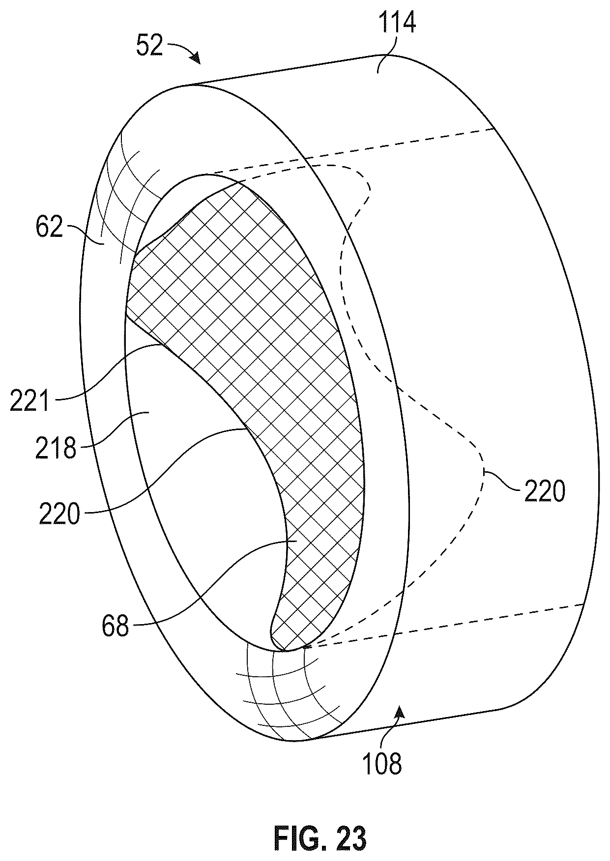 Patent US12590559 Figure 19 – Nacelle inlet duct for a ducted fan engine