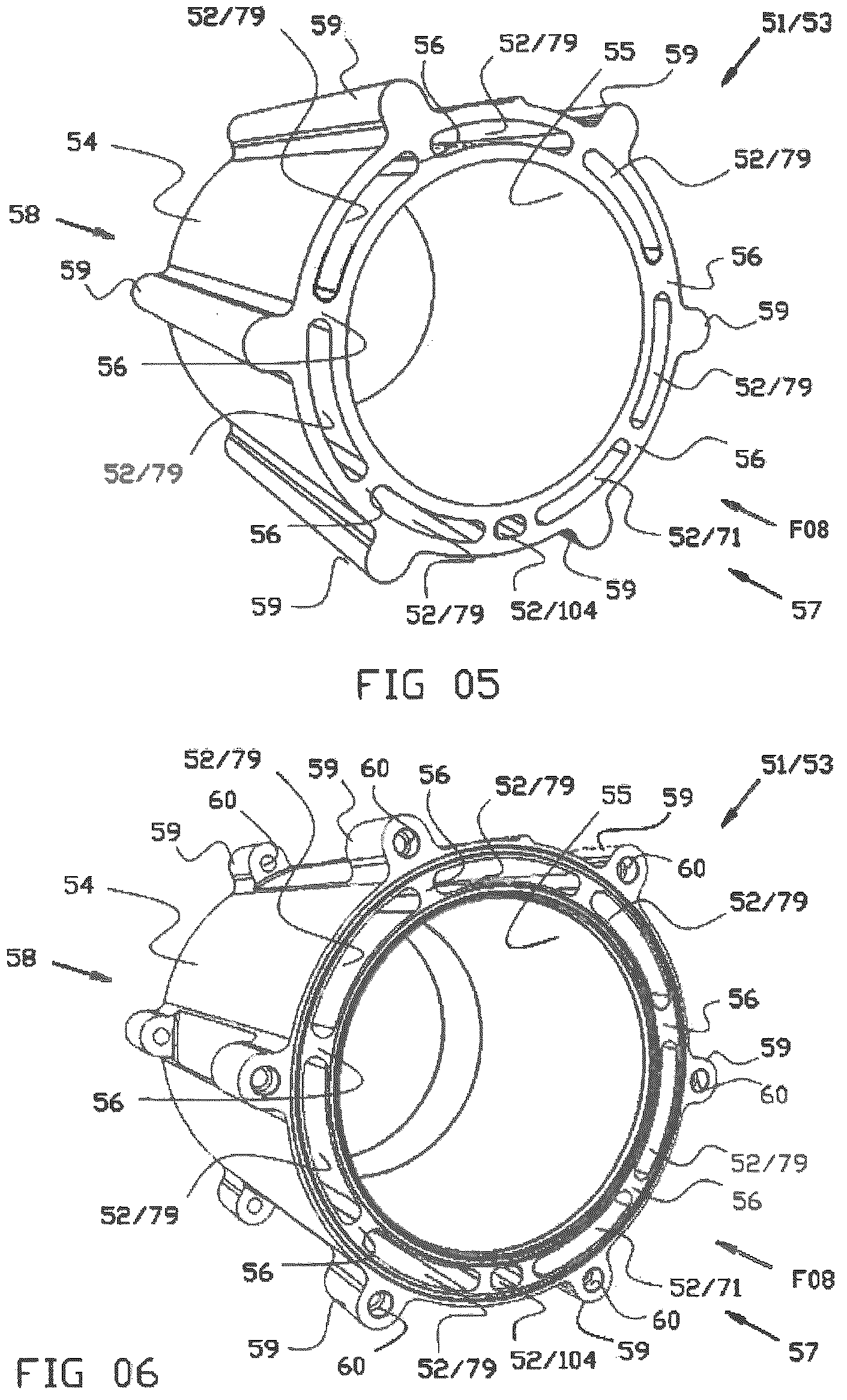 Patent US12590586 Figure 4 – Compressor assembly comprising a motor driving one or more compressor rotors and method for fabricating a housing part of such a compressor assembly