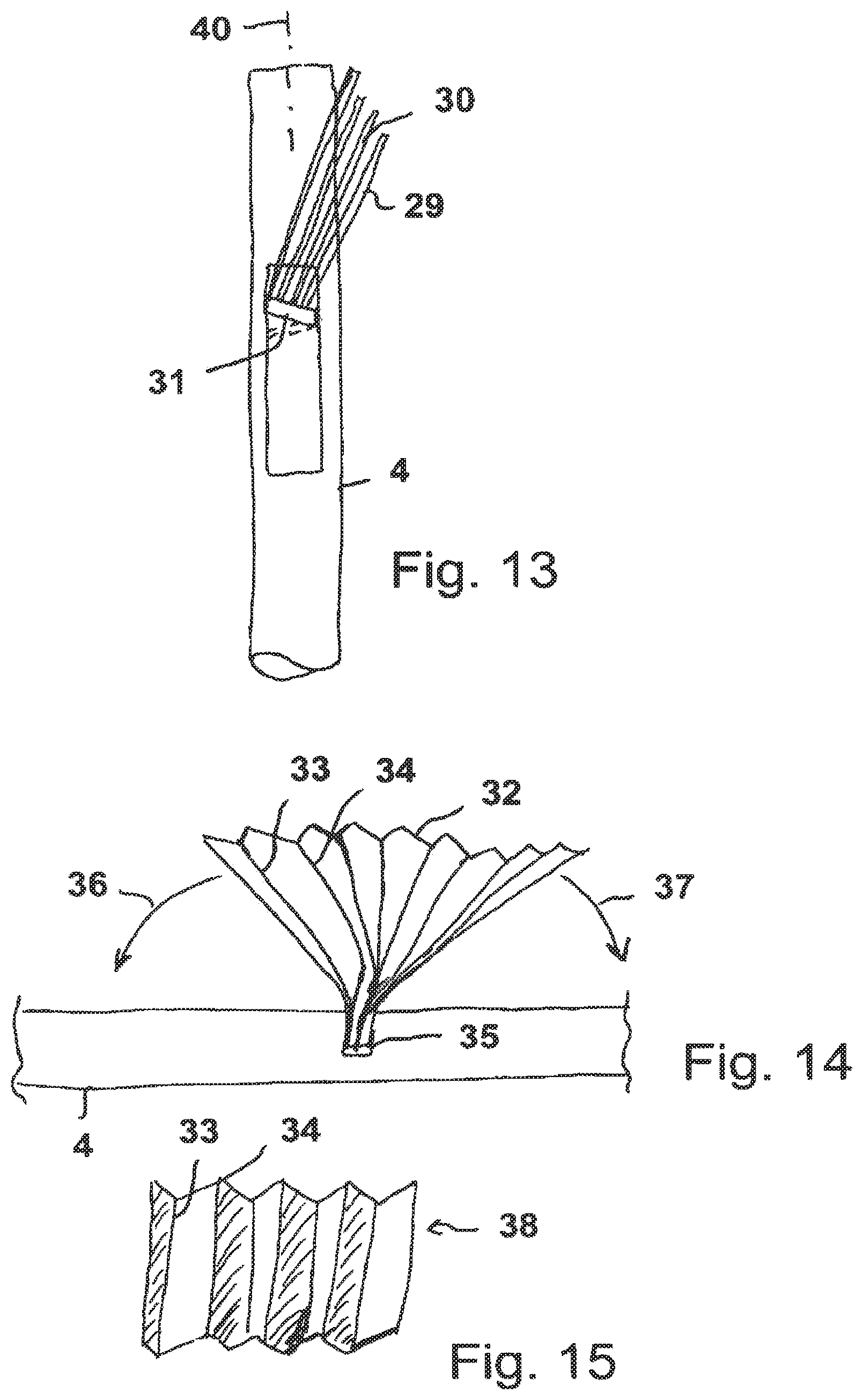 Patent US12590589 Figure 5 – Radially compressible and expandable rotor for a fluid pump