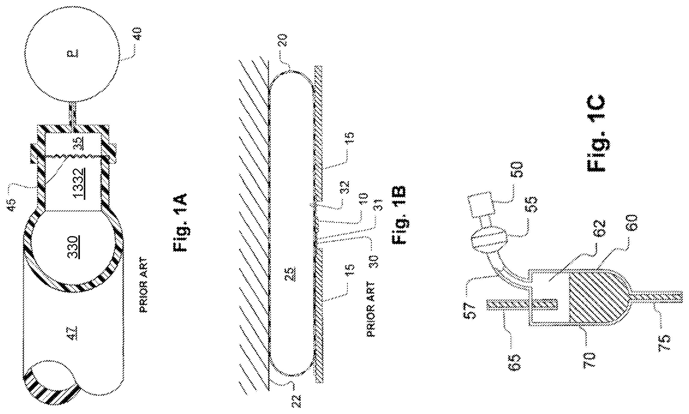 Patent US12590856 Figure 1 – Optical pressure measurement devices, methods, and systems