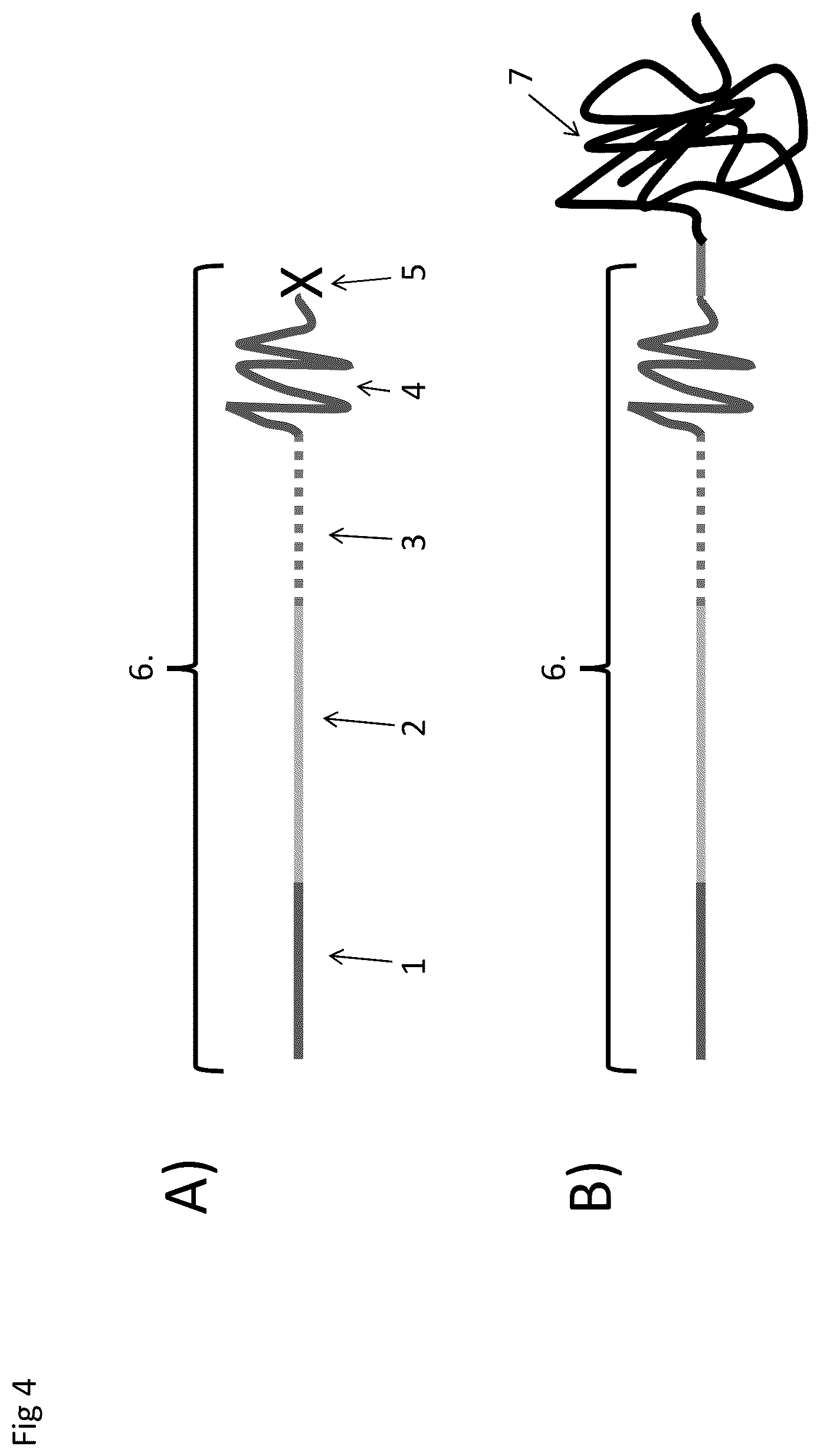 Patent US12590945 Figure 4 – Nanopore-based analysis of analytes