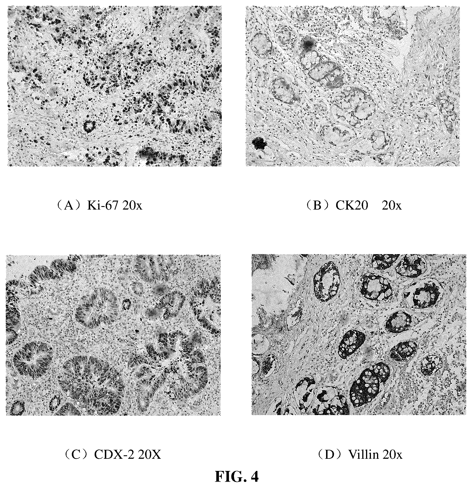 Patent US12590951 Figure 4 – Culture medium and culture method for primary cells of intestinal cancer
