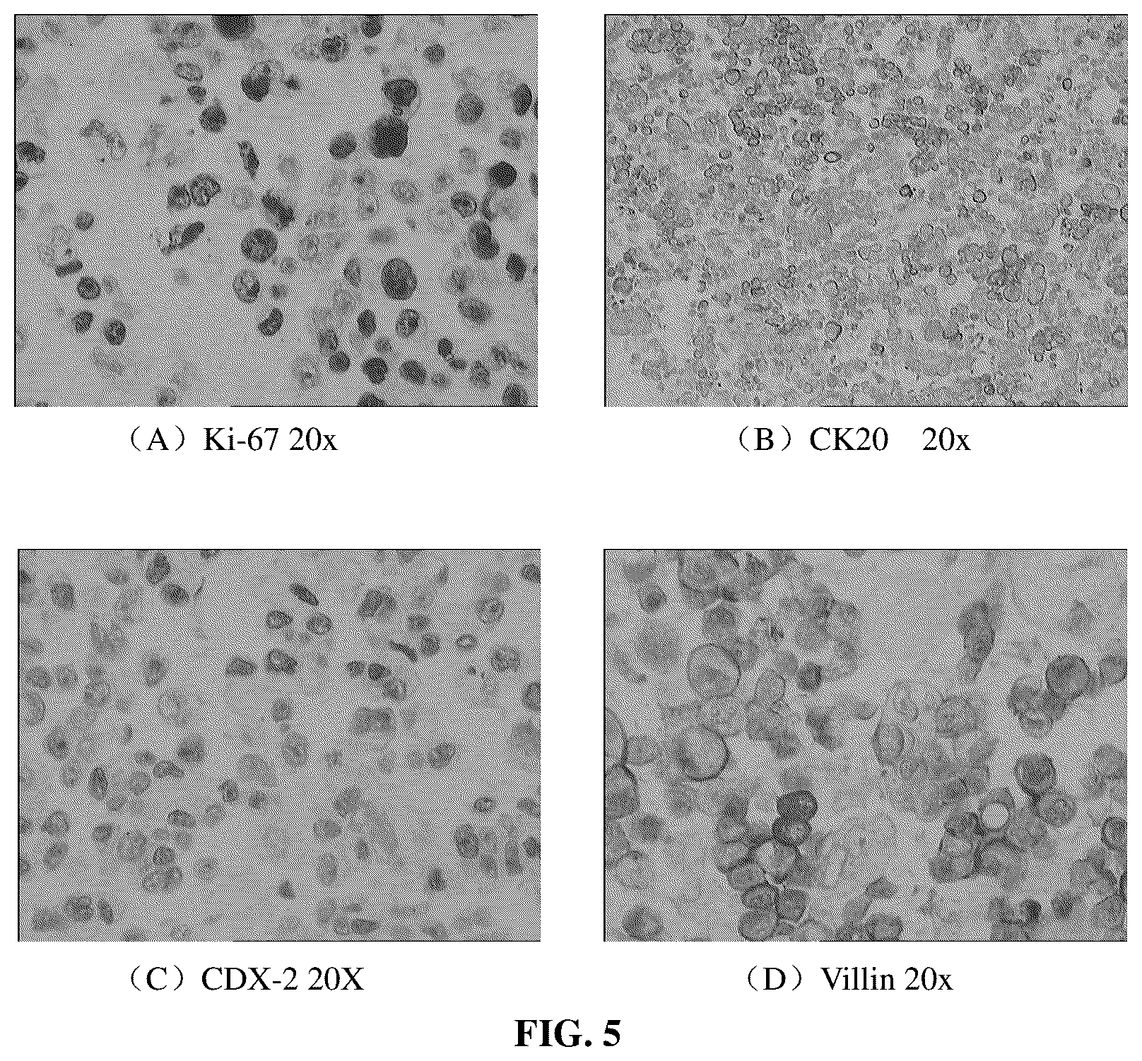 Patent US12590951 Figure 5 – Culture medium and culture method for primary cells of intestinal cancer
