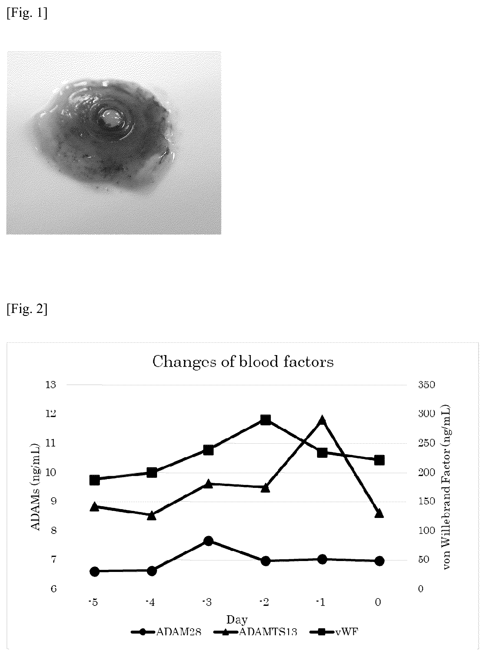 Patent US12590962 Figure 1 – Method for predicting formation of thrombus or risk of thrombus formation in medical device performing blood circulation by pump