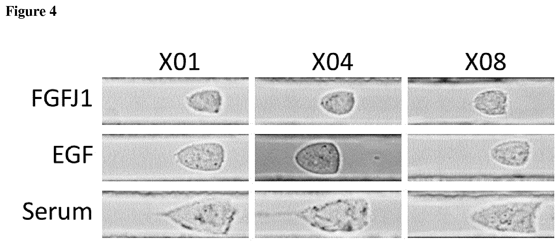 Patent US12590963 Figure 4 – Anti-cancer treatment of preselected subjects and screening methods to identify susceptible subjects