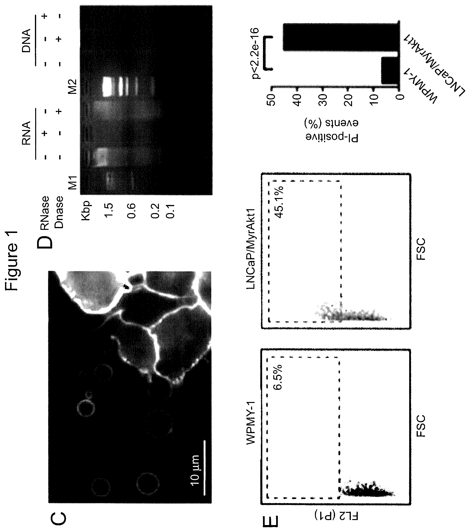 Patent US12590965 Figure 2 – Palmitoyl protein biomarkers in purified extracellular vesicles for early identification of clinically significant prostate cancer