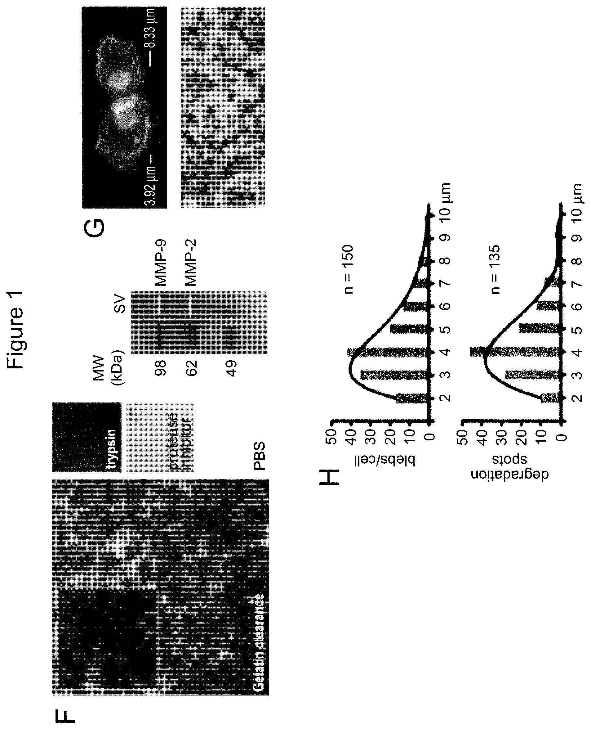 Patent US12590965 Figure 3 – Palmitoyl protein biomarkers in purified extracellular vesicles for early identification of clinically significant prostate cancer