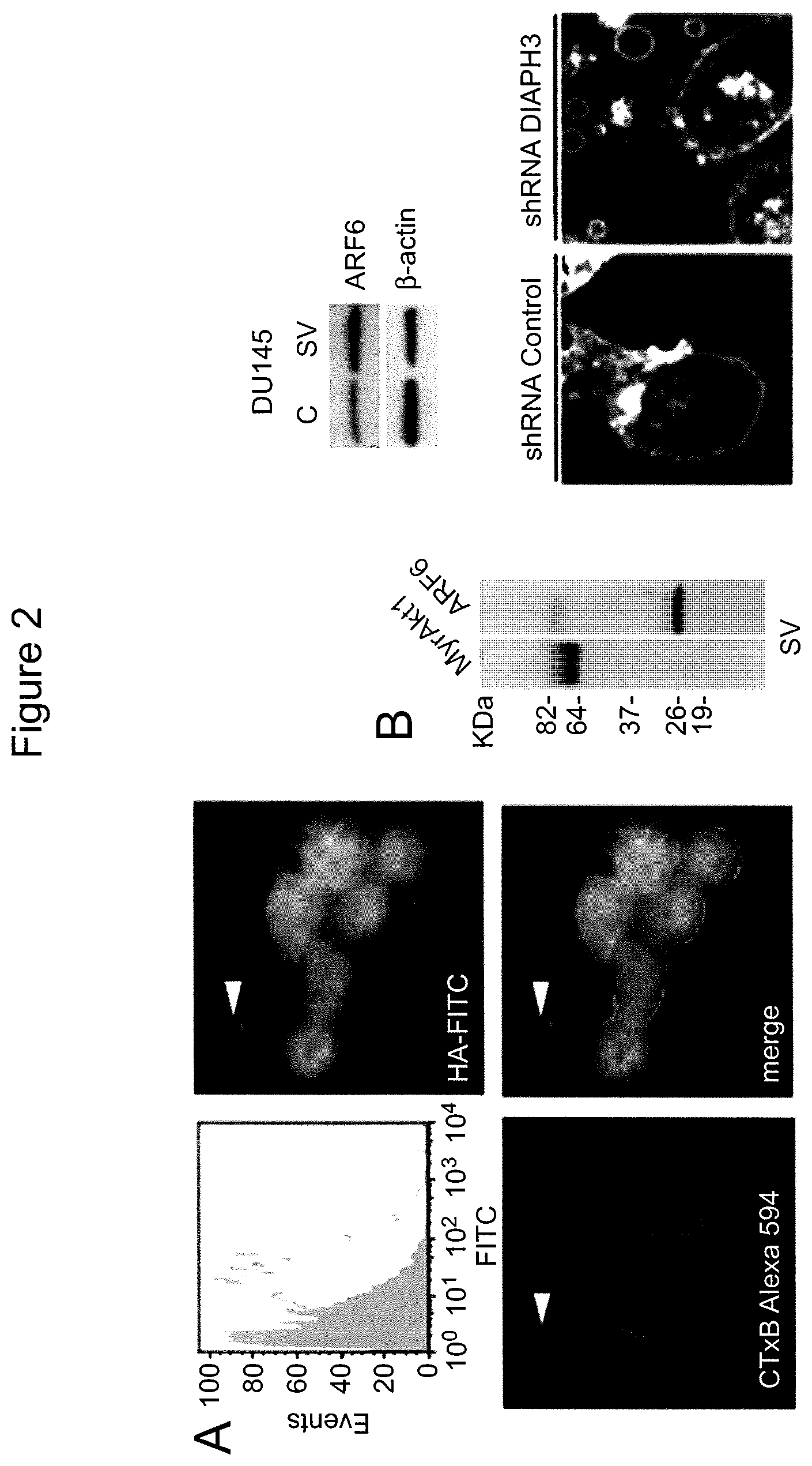 Patent US12590965 Figure 4 – Palmitoyl protein biomarkers in purified extracellular vesicles for early identification of clinically significant prostate cancer