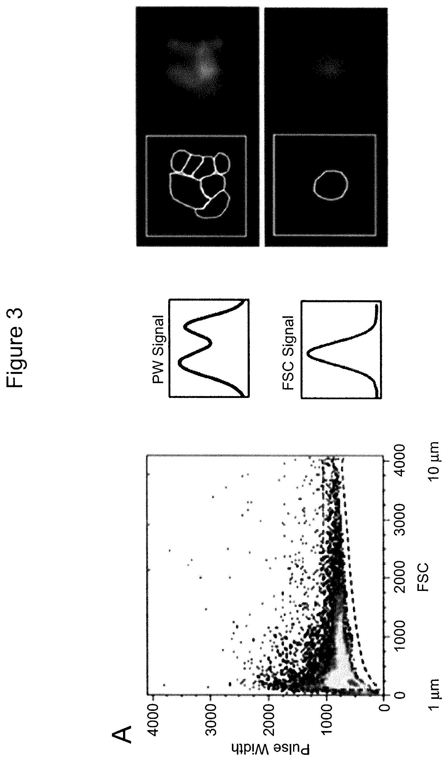 Patent US12590965 Figure 6 – Palmitoyl protein biomarkers in purified extracellular vesicles for early identification of clinically significant prostate cancer