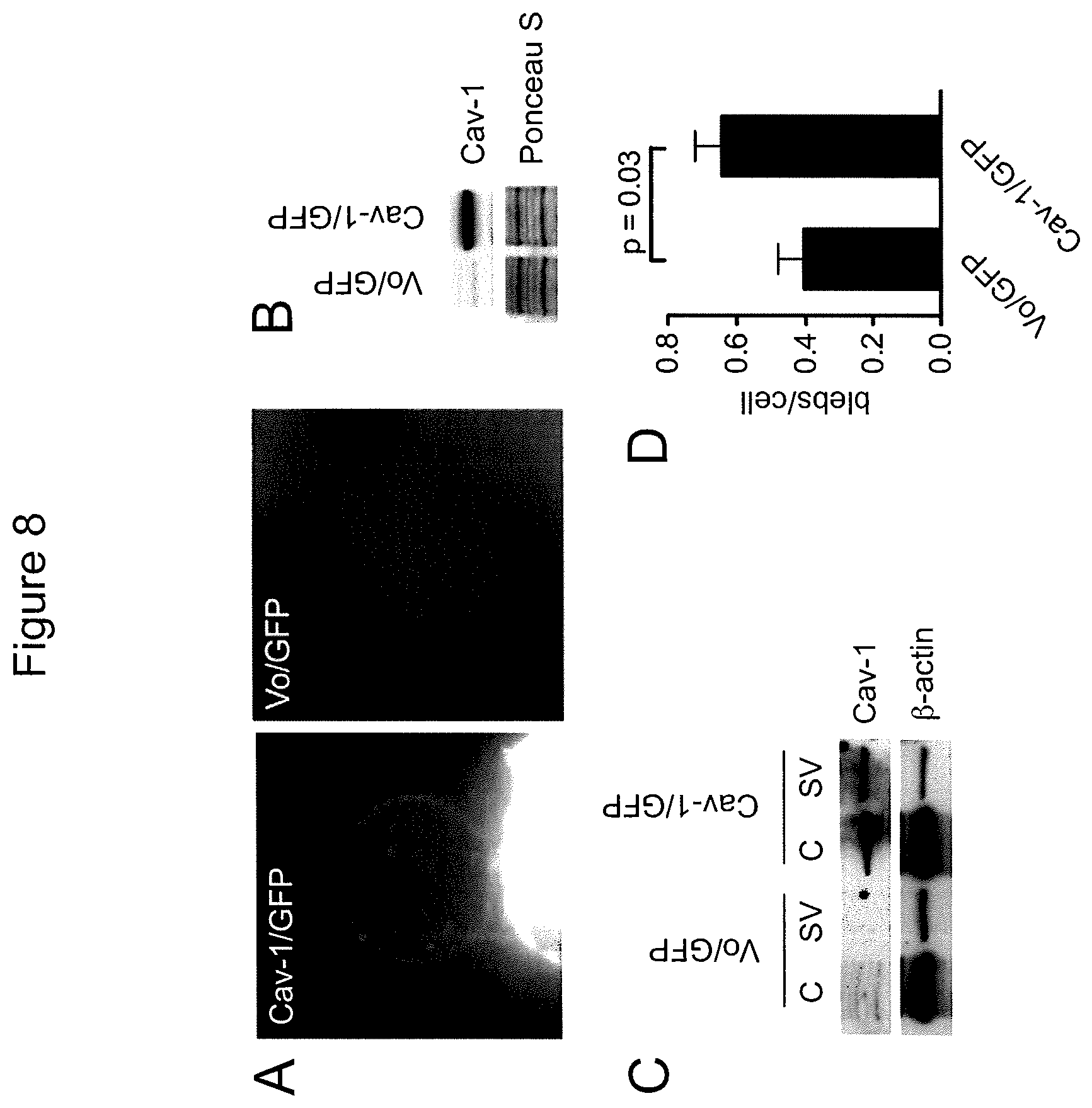 Patent US12590965 Figure 15 – Palmitoyl protein biomarkers in purified extracellular vesicles for early identification of clinically significant prostate cancer