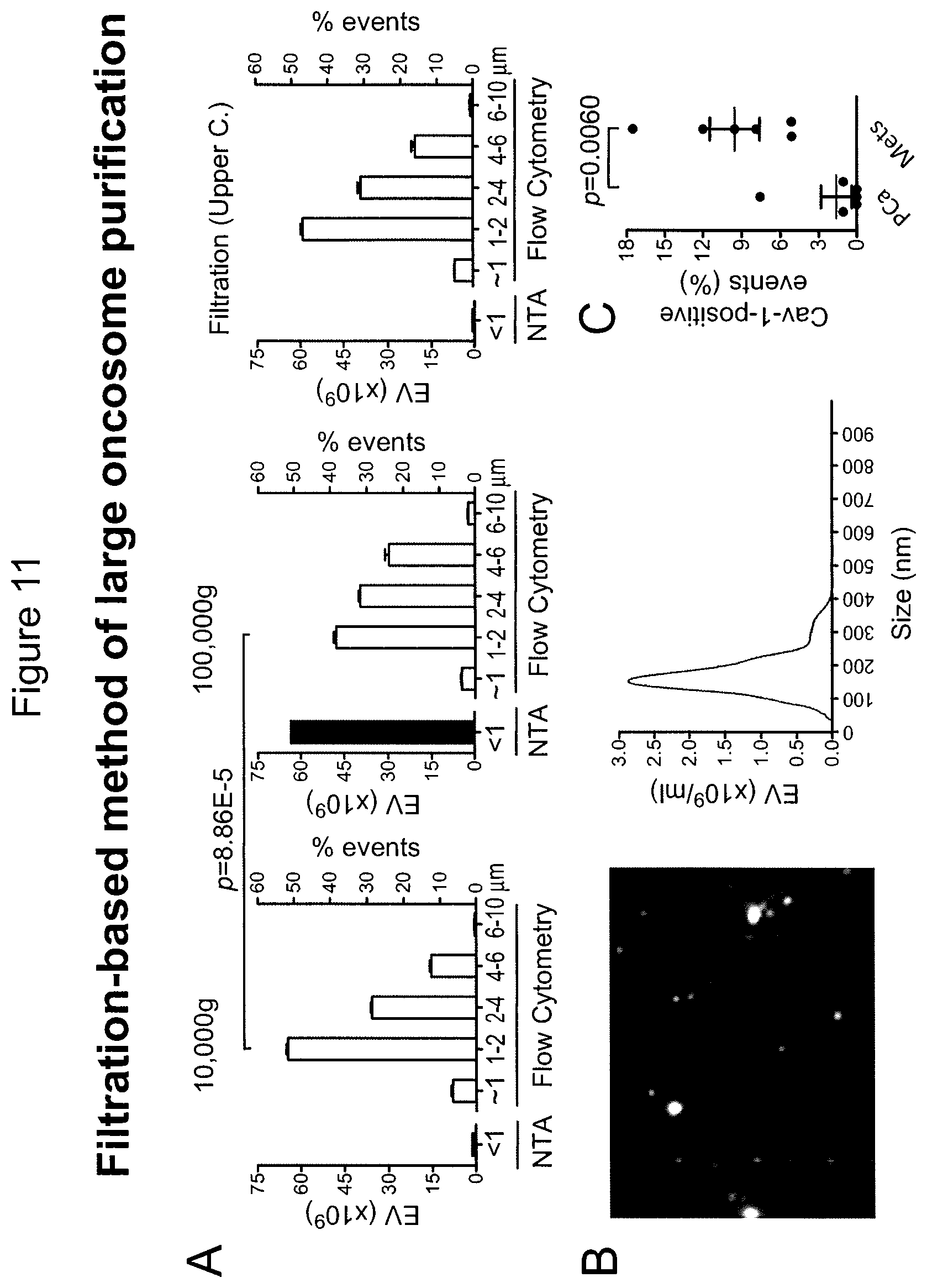 Patent US12590965 Figure 18 – Palmitoyl protein biomarkers in purified extracellular vesicles for early identification of clinically significant prostate cancer