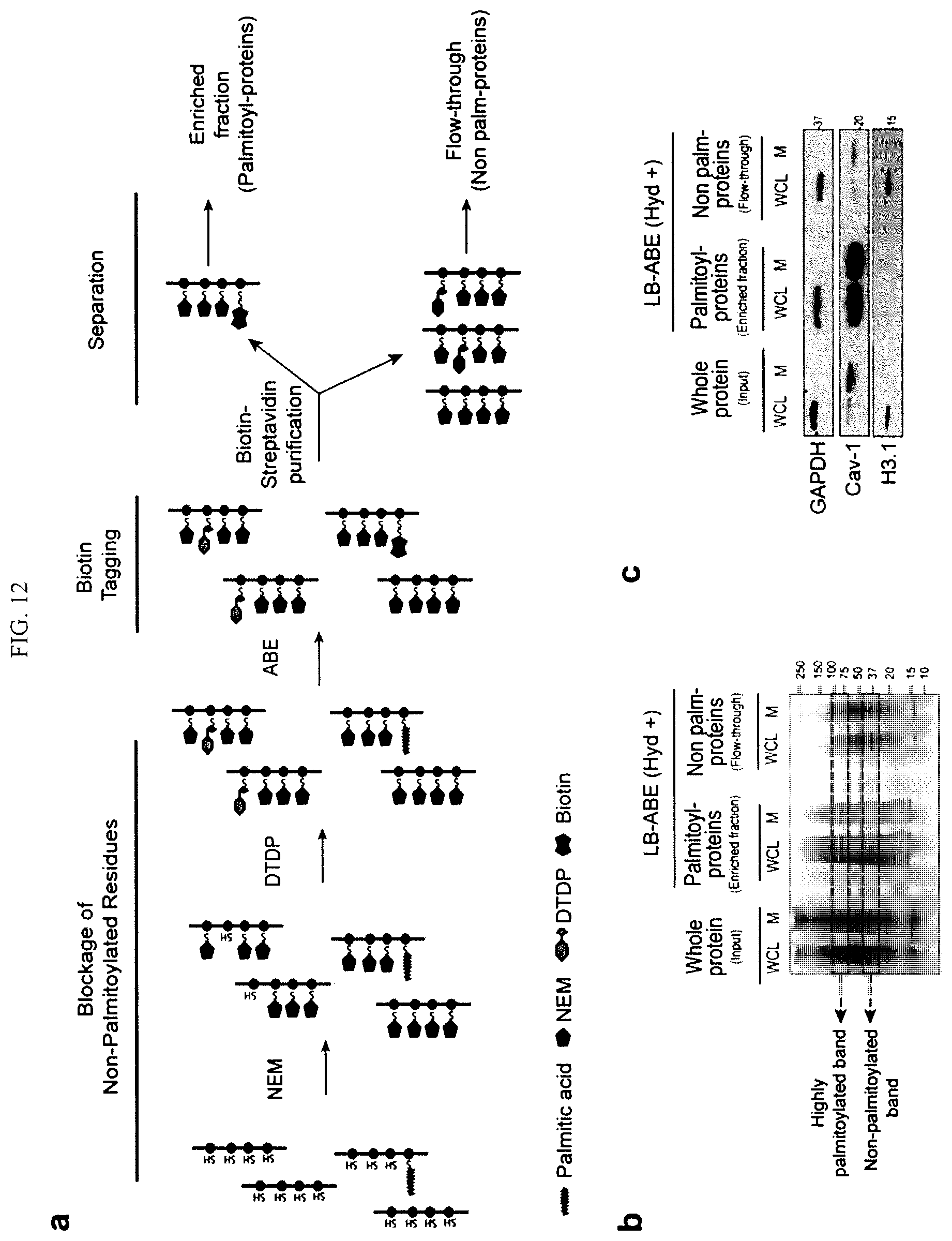 Patent US12590965 Figure 19 – Palmitoyl protein biomarkers in purified extracellular vesicles for early identification of clinically significant prostate cancer